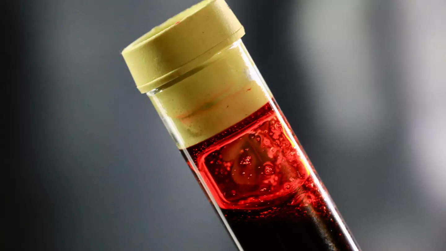 Scientists say people with one blood type are more likely to have a stroke before they’re 60