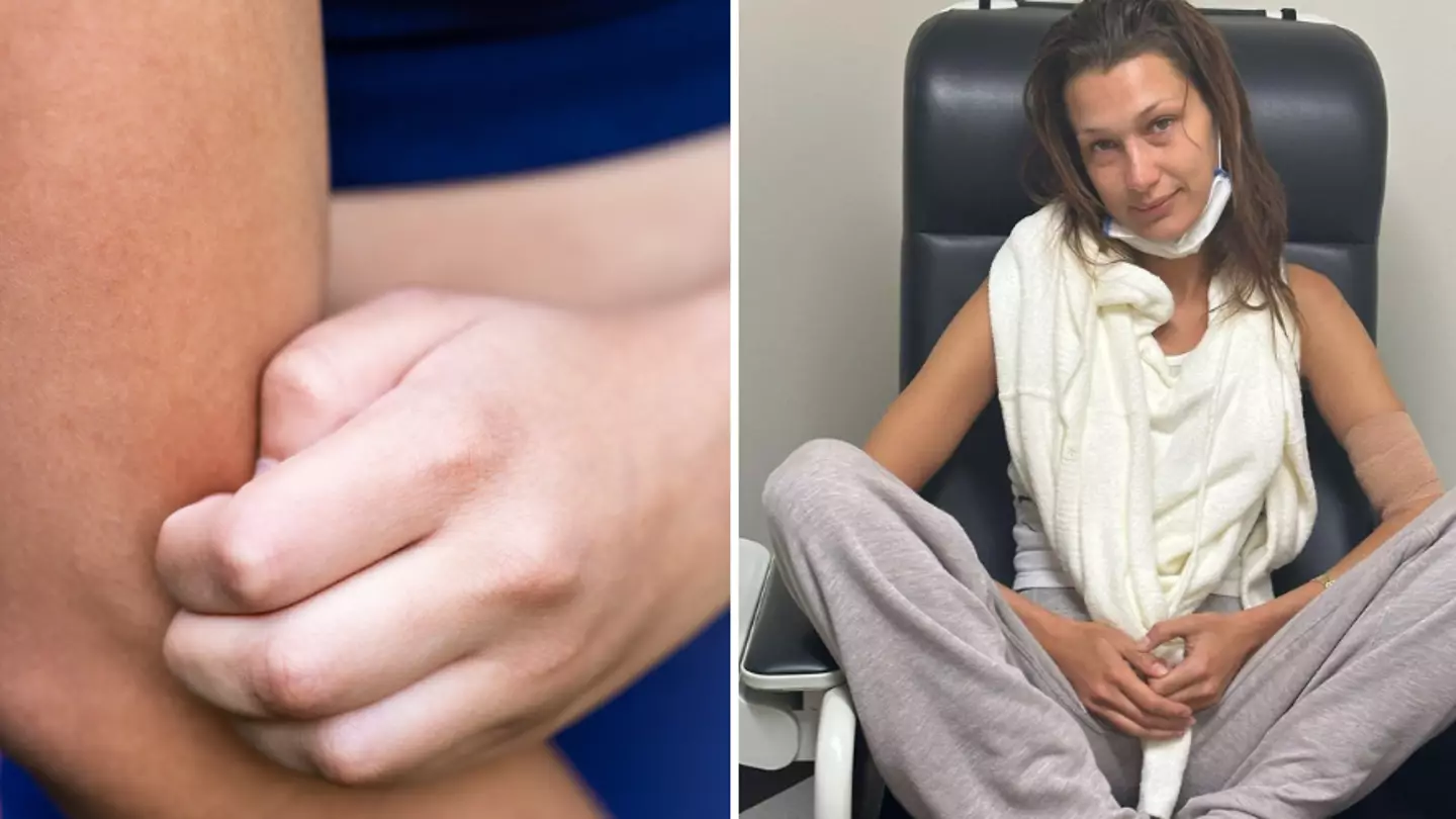 Symptoms of disease that so many celebrities are being diagnosed with after expert gives explanation for why it’s so common