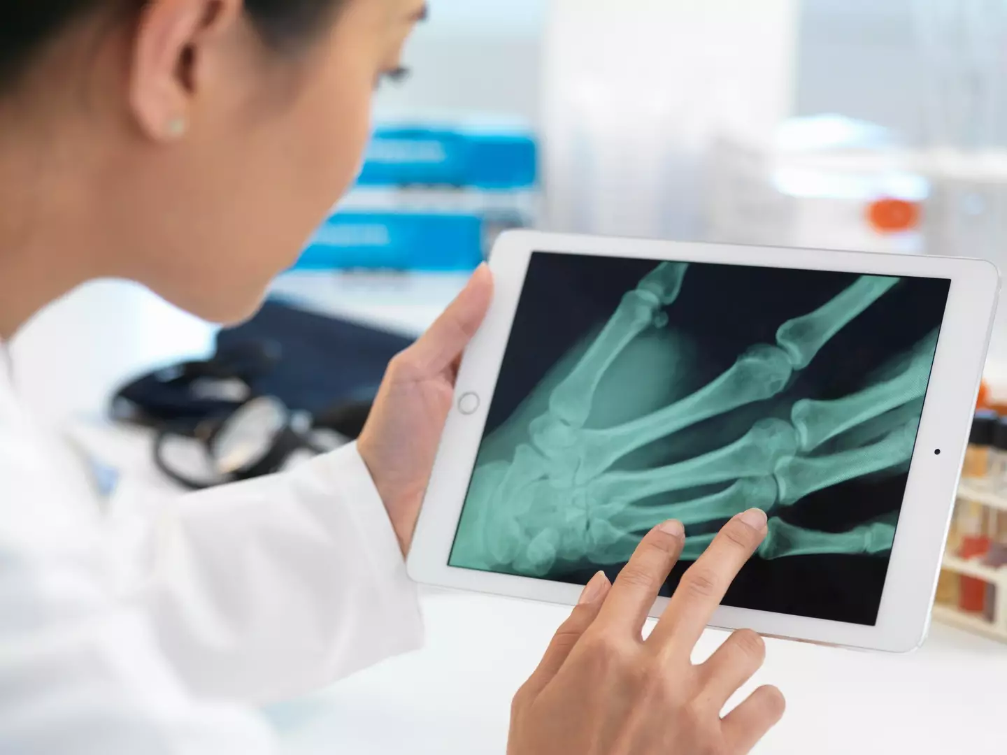 A doctor says there could be other reasons why someone has avoided breaking a bone (Andrew Brookes/Getty)