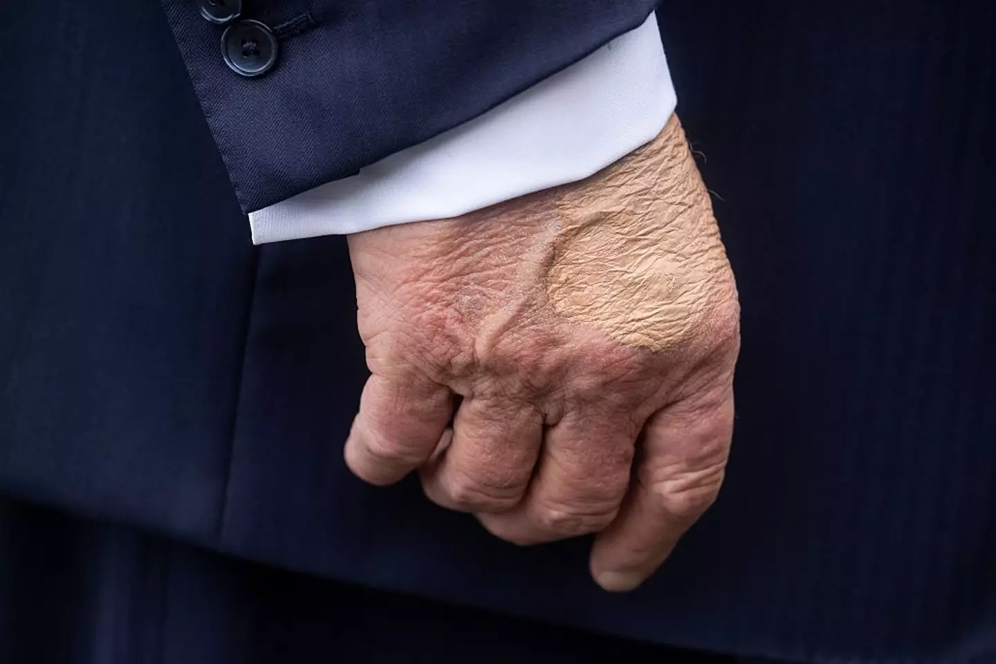 The 79-year-old Republican was spotted with body make-up covering up the bruise on his right hand (JIM WATSON / Contributor / Getty Images)