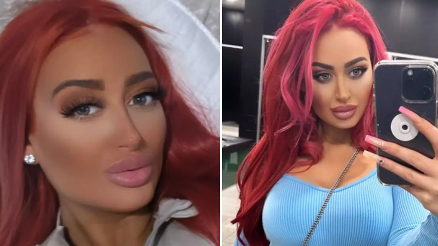 Mum who went back to work five days after giving birth says c-sections are a cop out