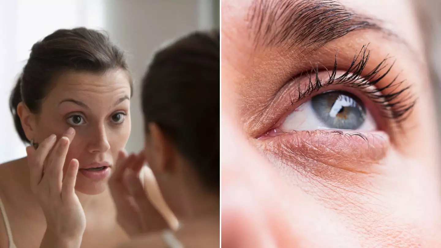 Getty/Jose Luis Pelaez/Lourdes Balduque