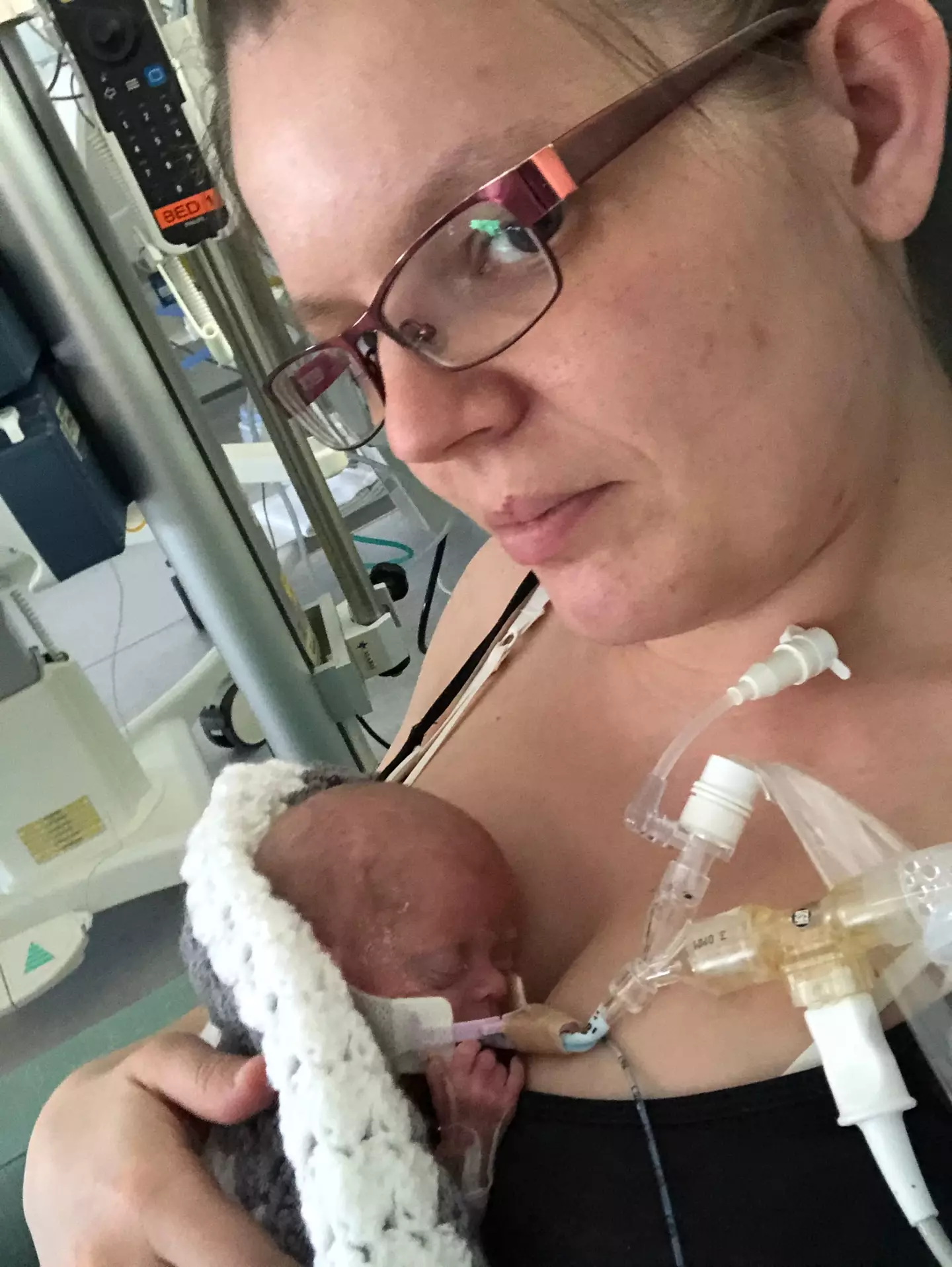 Michaela gave birth to the triplets at just 22 weeks and five days.