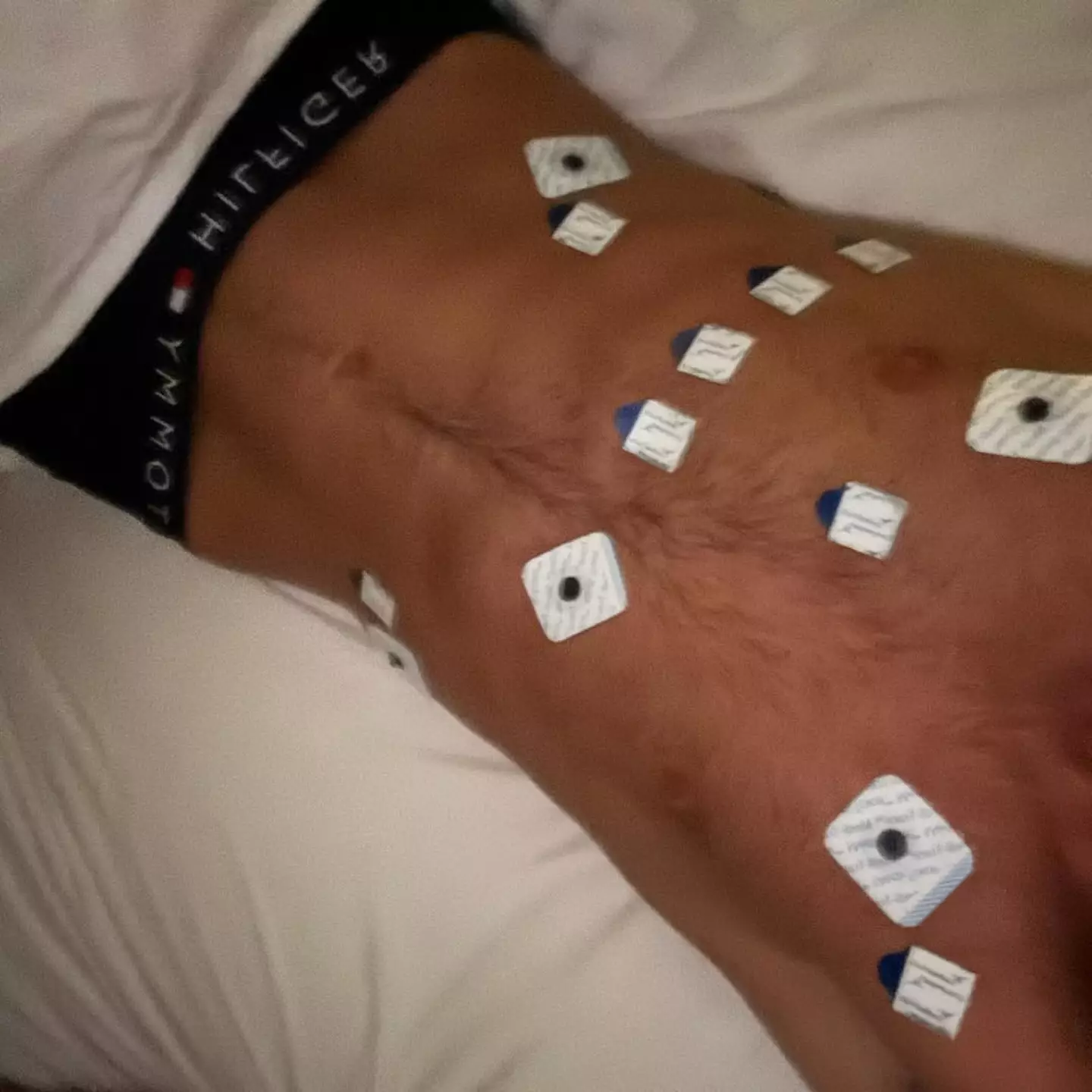 He's vowed to never touch a vape again (Instagram/@fraserolender)