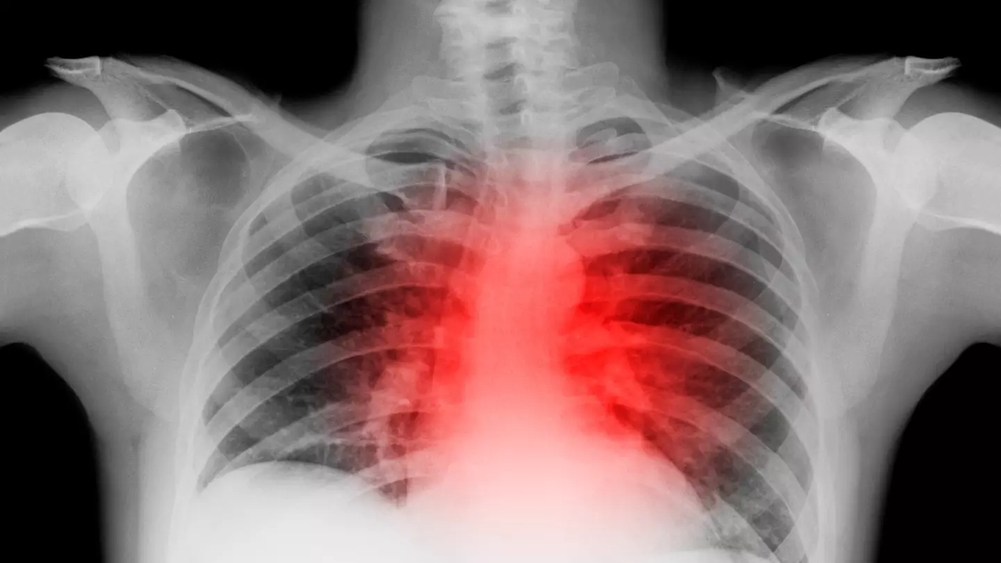 ‘Silent killer’ warning as doctors address hidden disease with no symptoms