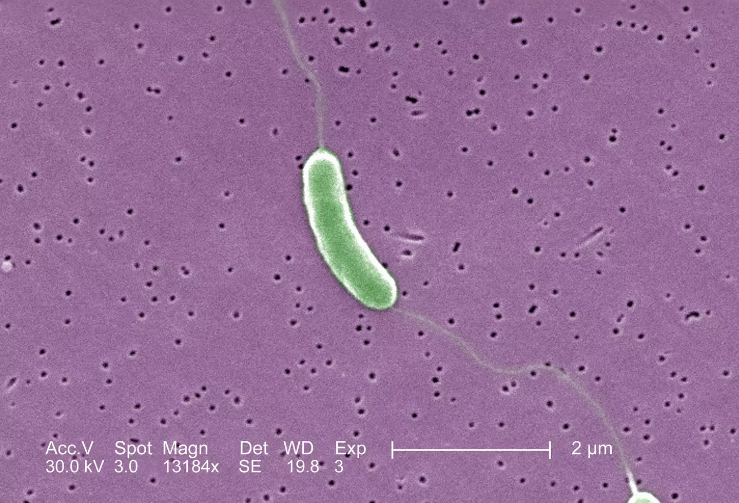 Two people have died after contracting a rare flesh-eating bacteria (Getty Stock Image)
