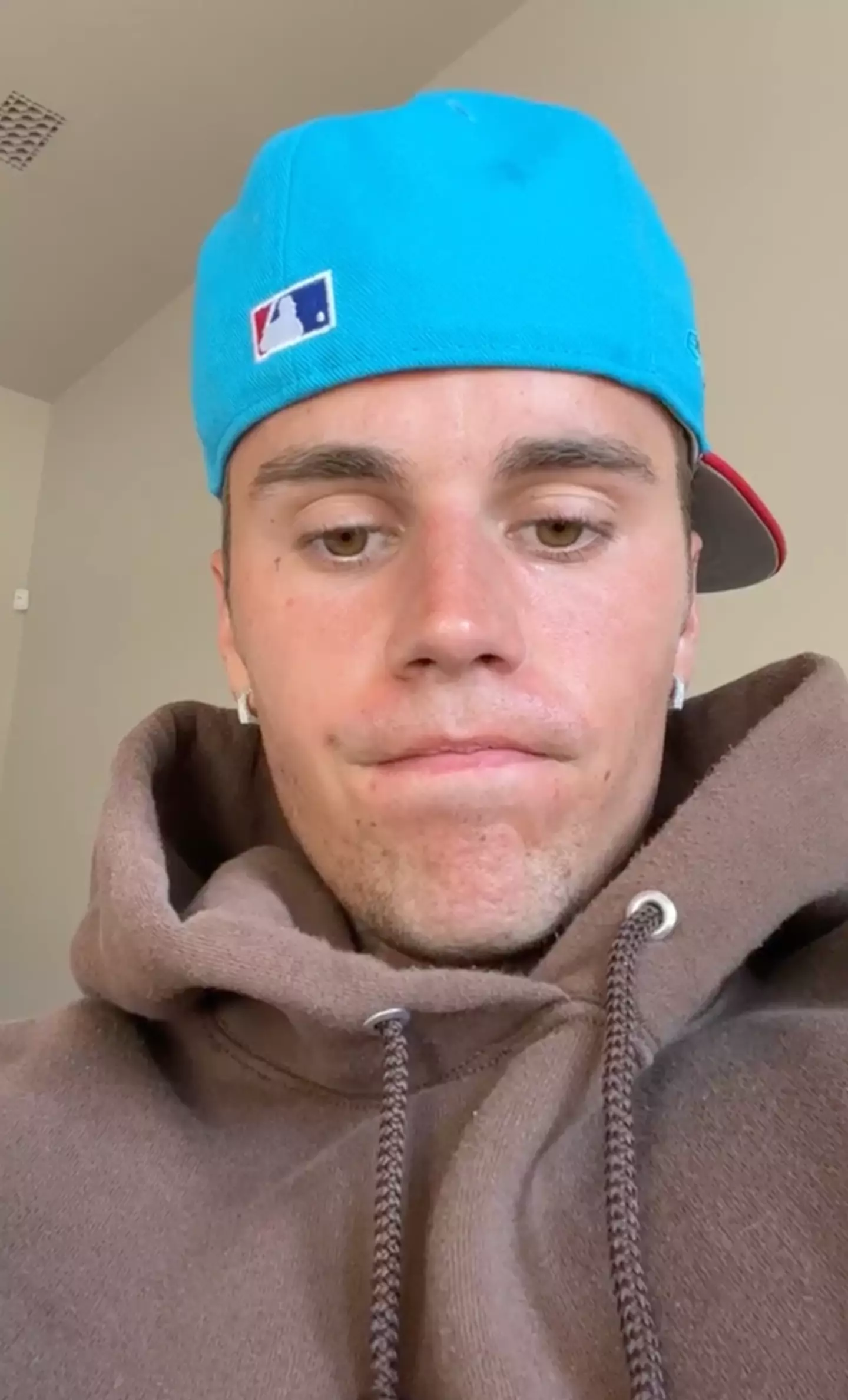 Justin Bieber was diagnosed in 2020. (Instagram/@justinbieber)