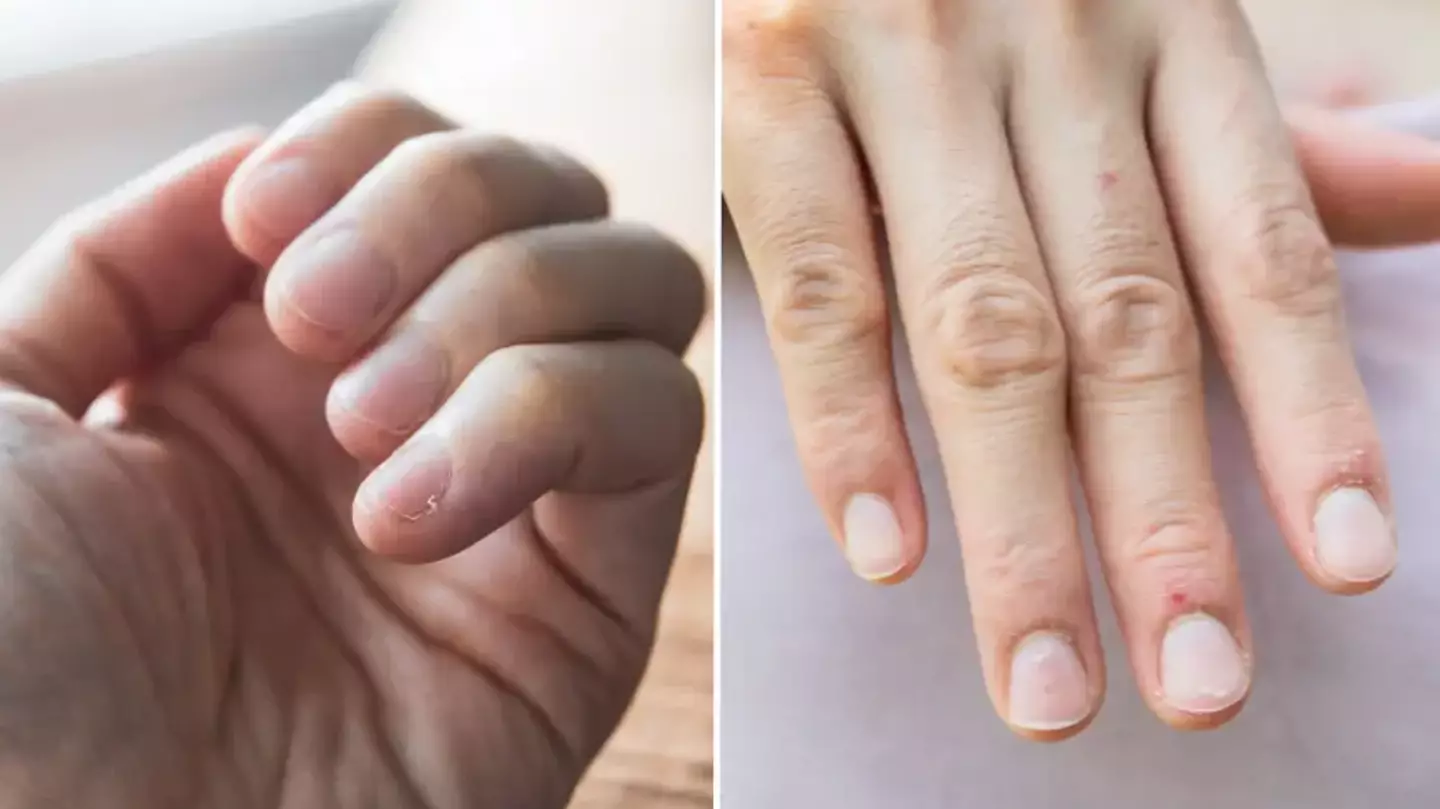 Doctor reveals warning sign of silent killer that you might spot in your hand