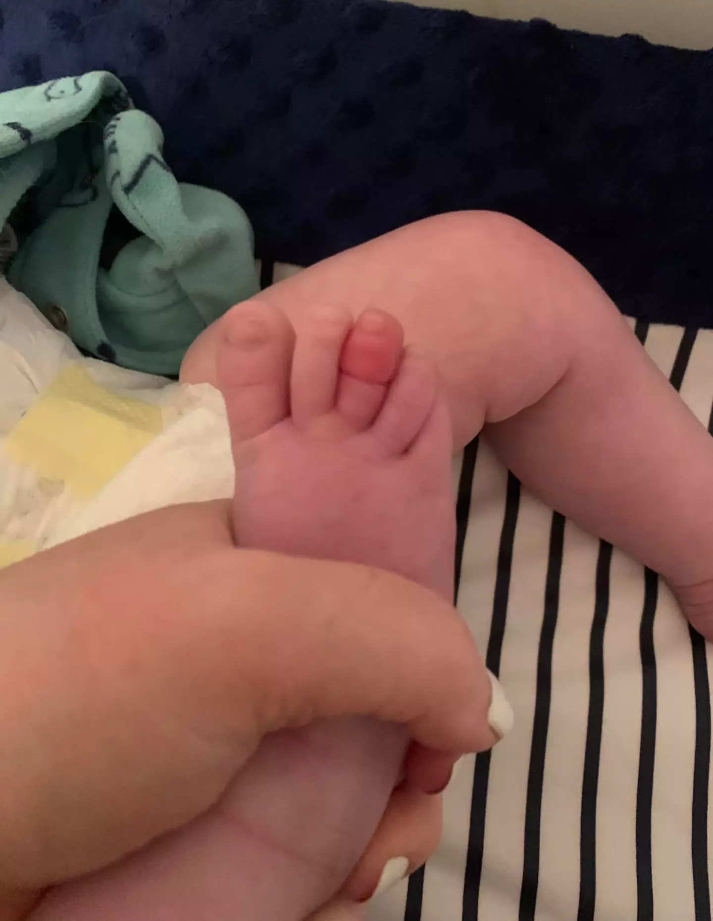 Logan had to go to hospital when a hair got wrapped around his toe.