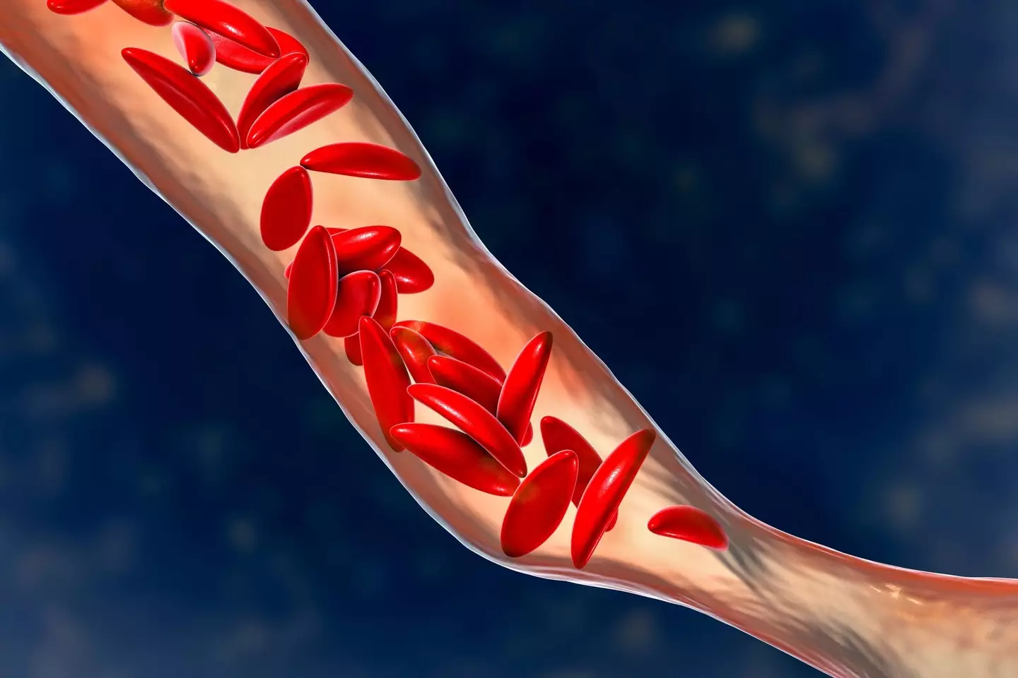 He noticed blood in his stool (Getty Stock Images)