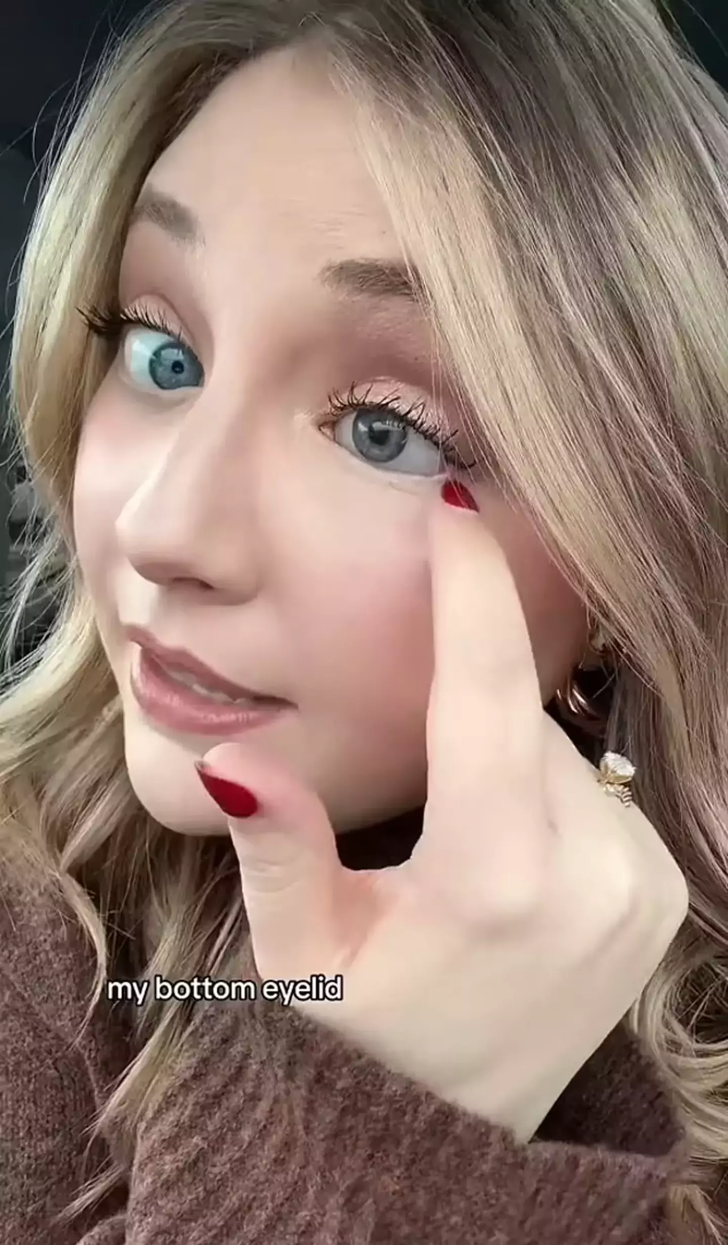 The 29-year-old has since used her story to raise awareness on the dangers of shattering sunglasses.