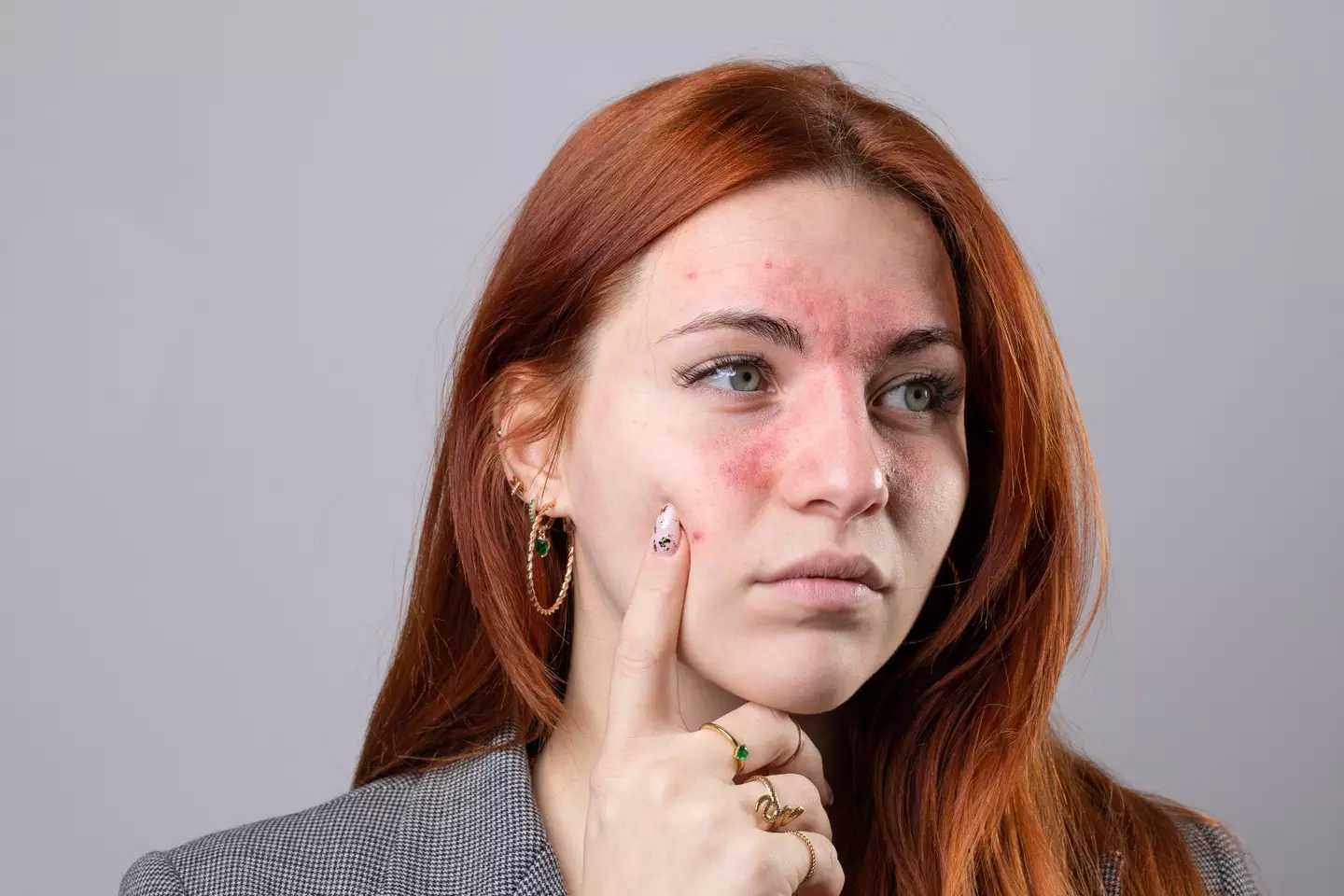 The condition can prove particularly painful (Getty Stock Image)