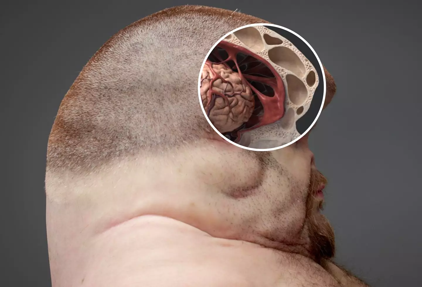 Graham's skull has more fluid and more ligaments to support the brain (TAC/Patricia Piccinini)
