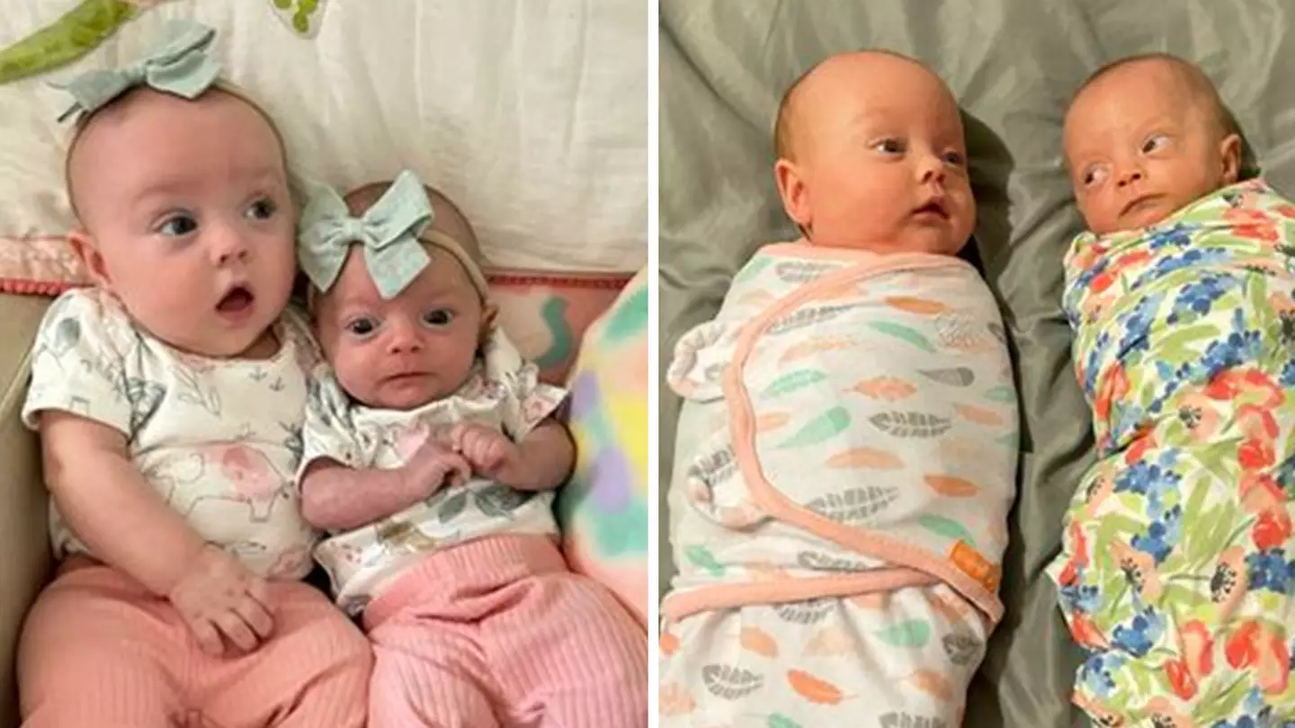 Mum Gives Birth To Twins But One Is Three Times Smaller Than The Other