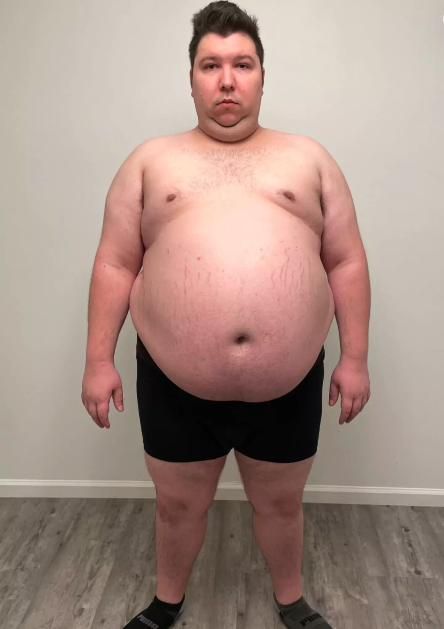 The YouTuber claimed earlier this month to have lost 250 of the pounds he gained whilst creating Mukbang content (Instagram/@real_nikocado)