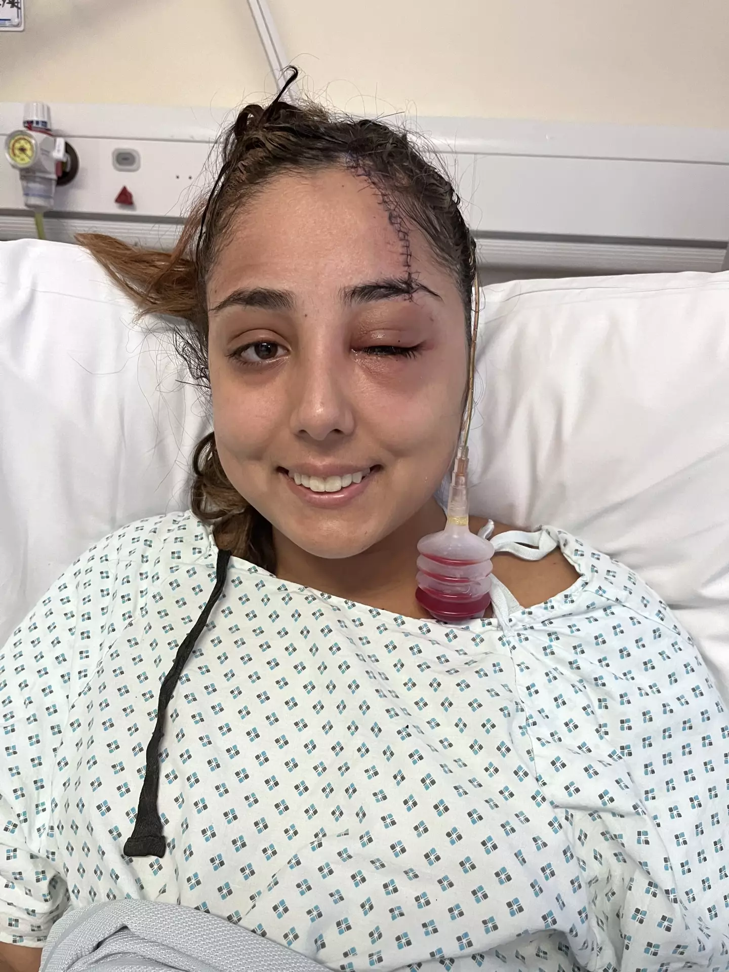 The horrific incident occurred when Jeena Panesar lost control of the car while driving home from work in Swadlincote, Derbyshire on January 24th.