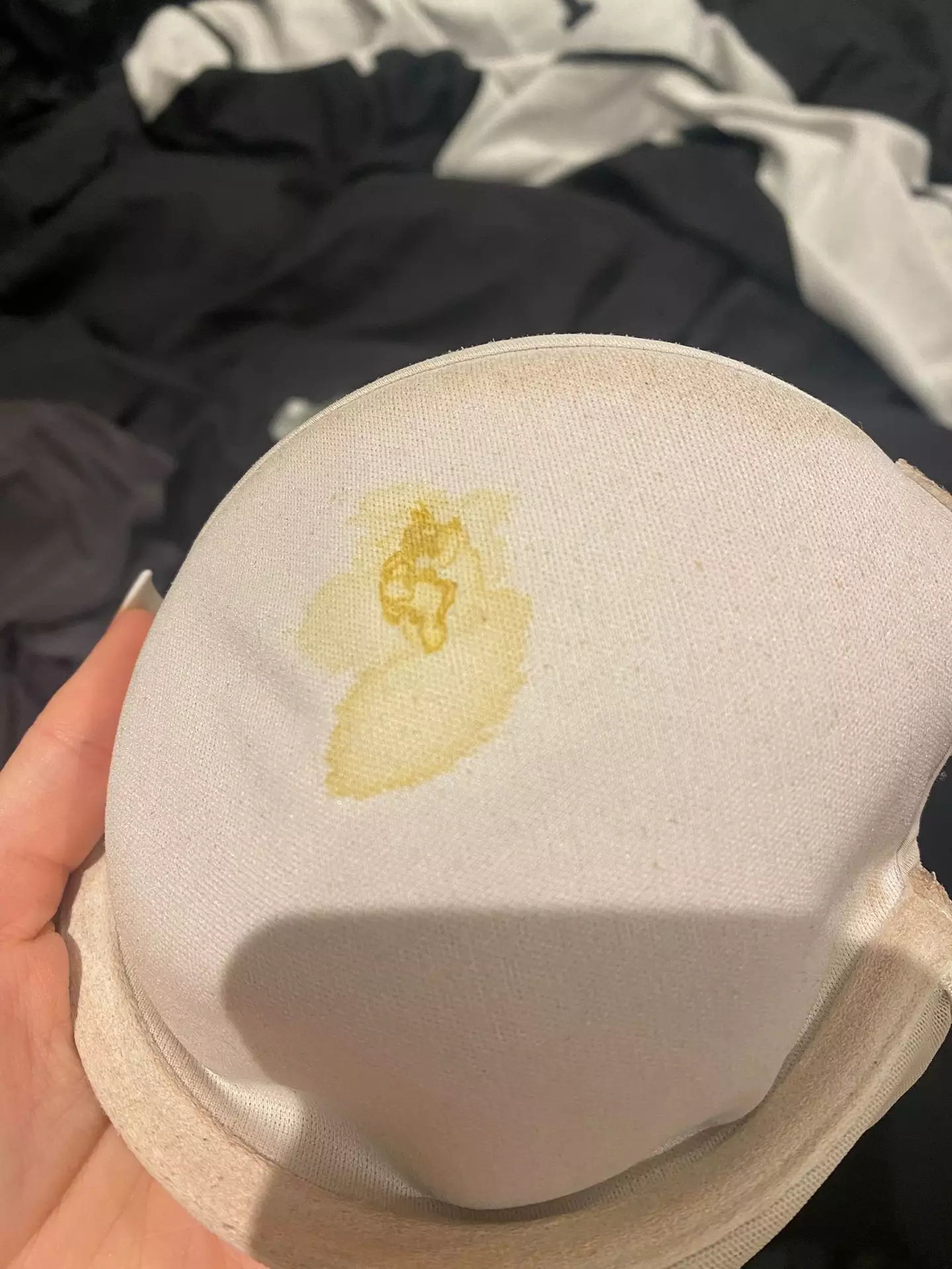 Her nipple began leaking a sticky, yellow discharge.
