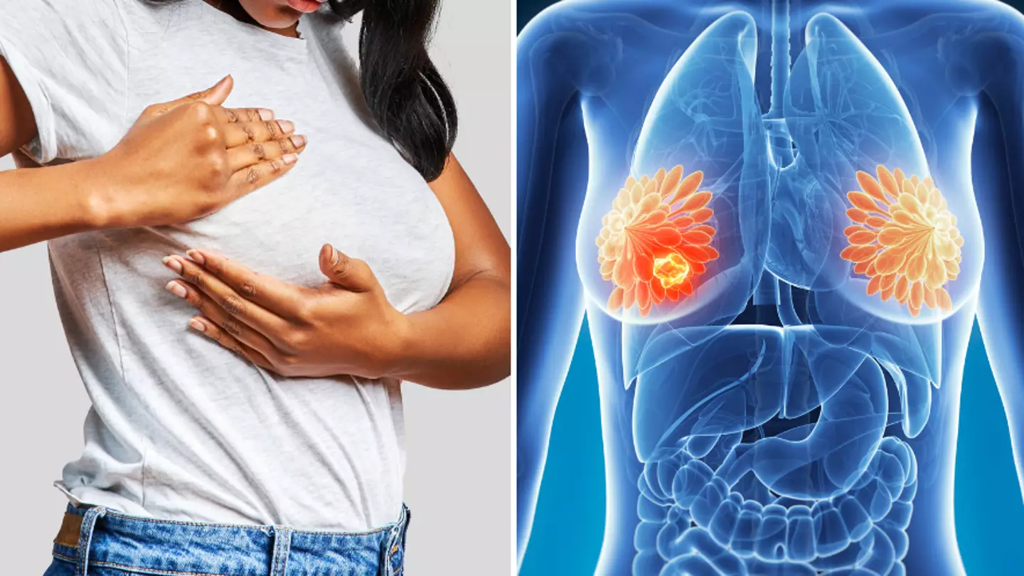 Four skin changes to look out for that could be a sign of breast cancer