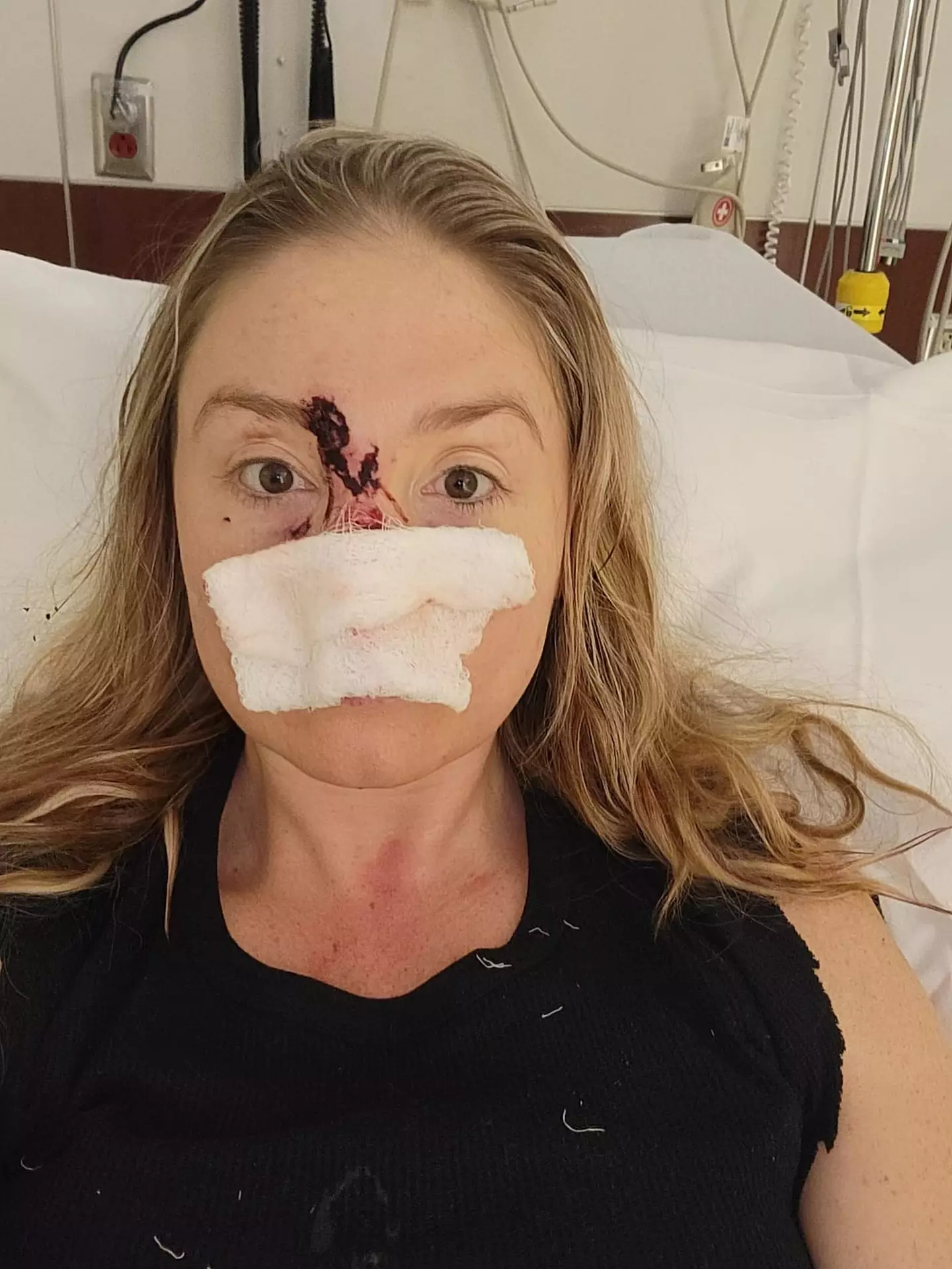 After the attack, Olivia felt for her nose but it 'wasn't there'.