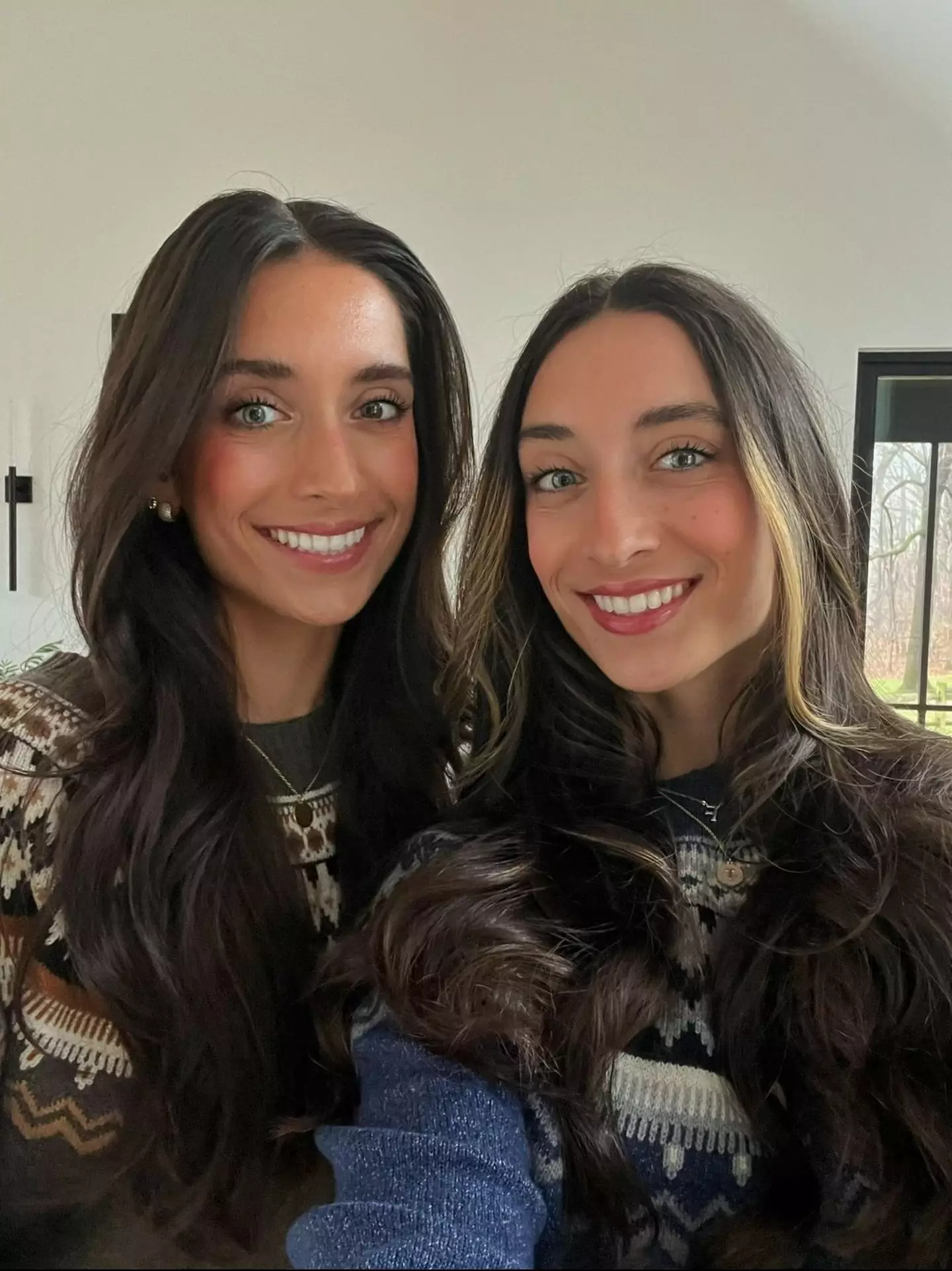 There is one big difference between the identical twins (SWNS)