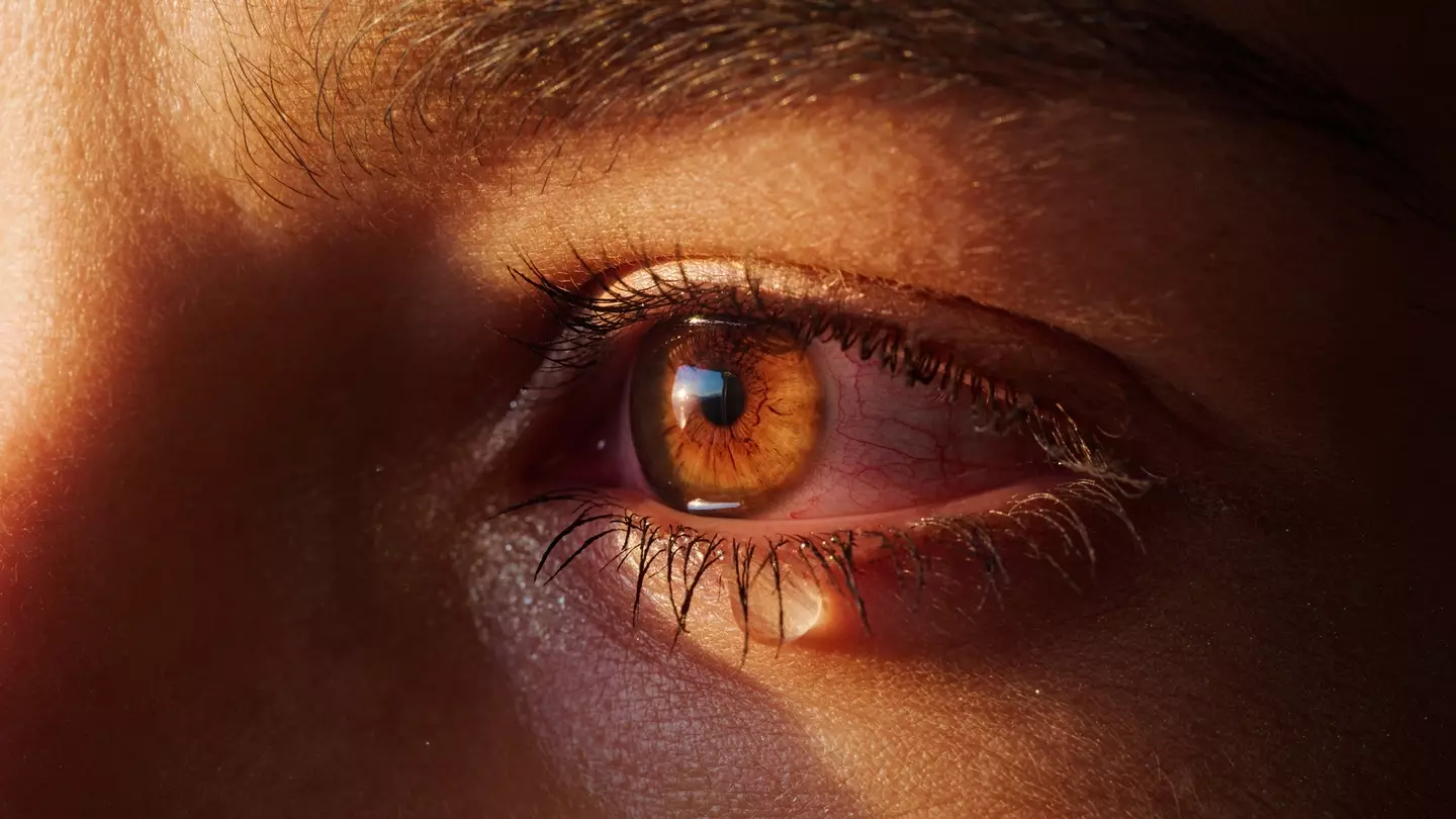 The expert pointed to one major sign in order to spot 'trauma eyes' (janiecbros / Getty Images)