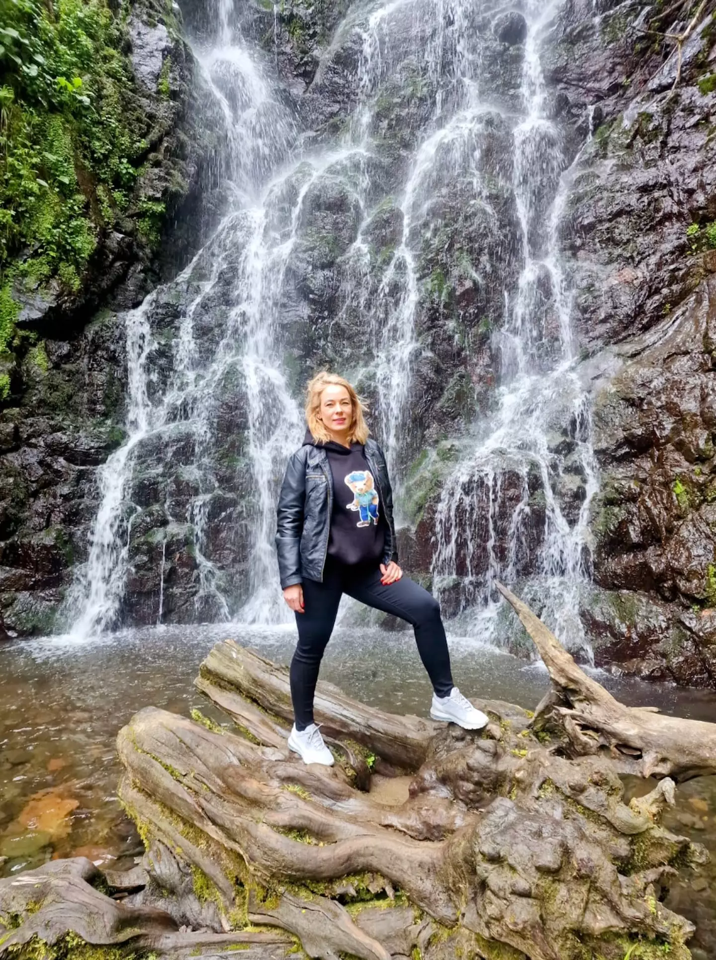 Edita says she'd noticed extreme bruising on other parts of her body. (Supplied)