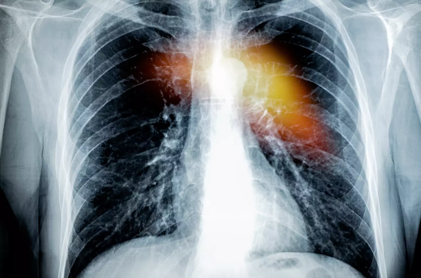 Some vape addicts might experience an ailment nicknamed 'popcorn lung' (Getty Stock Images)