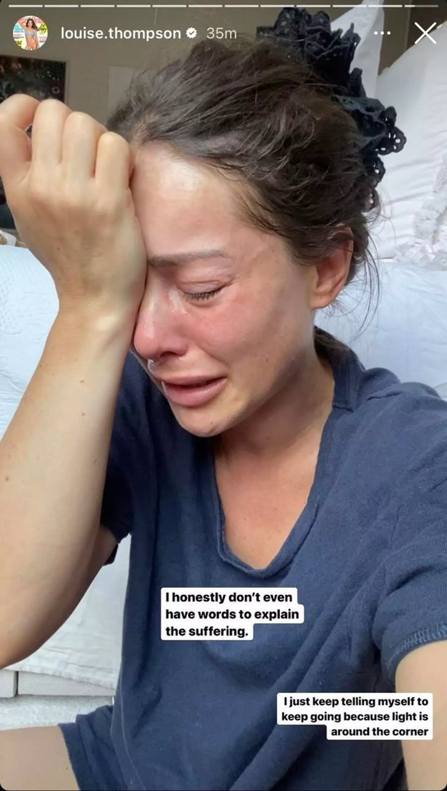 Louise has PTSD and anxiety.