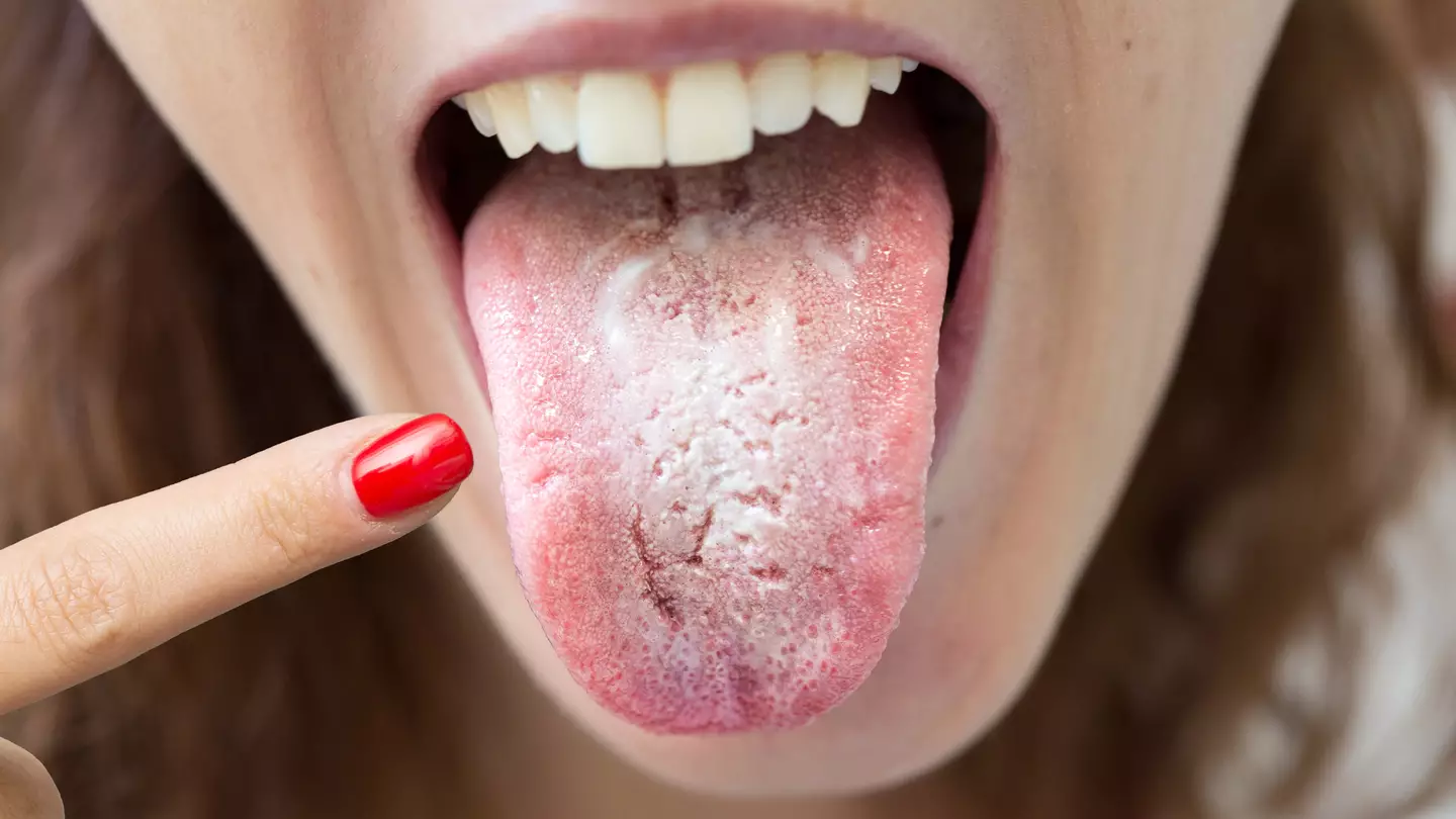Seriously gross reasons why you might wake up with bad taste lingering in your mouth