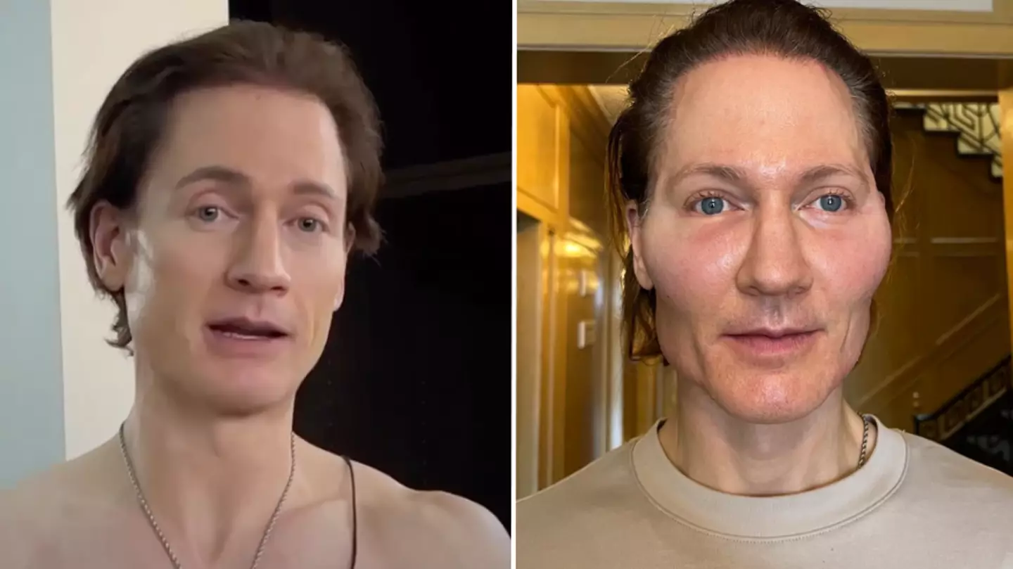 Biohacker who spends $2 million a year to look '18 years old' reveals horrific side effect of one procedure