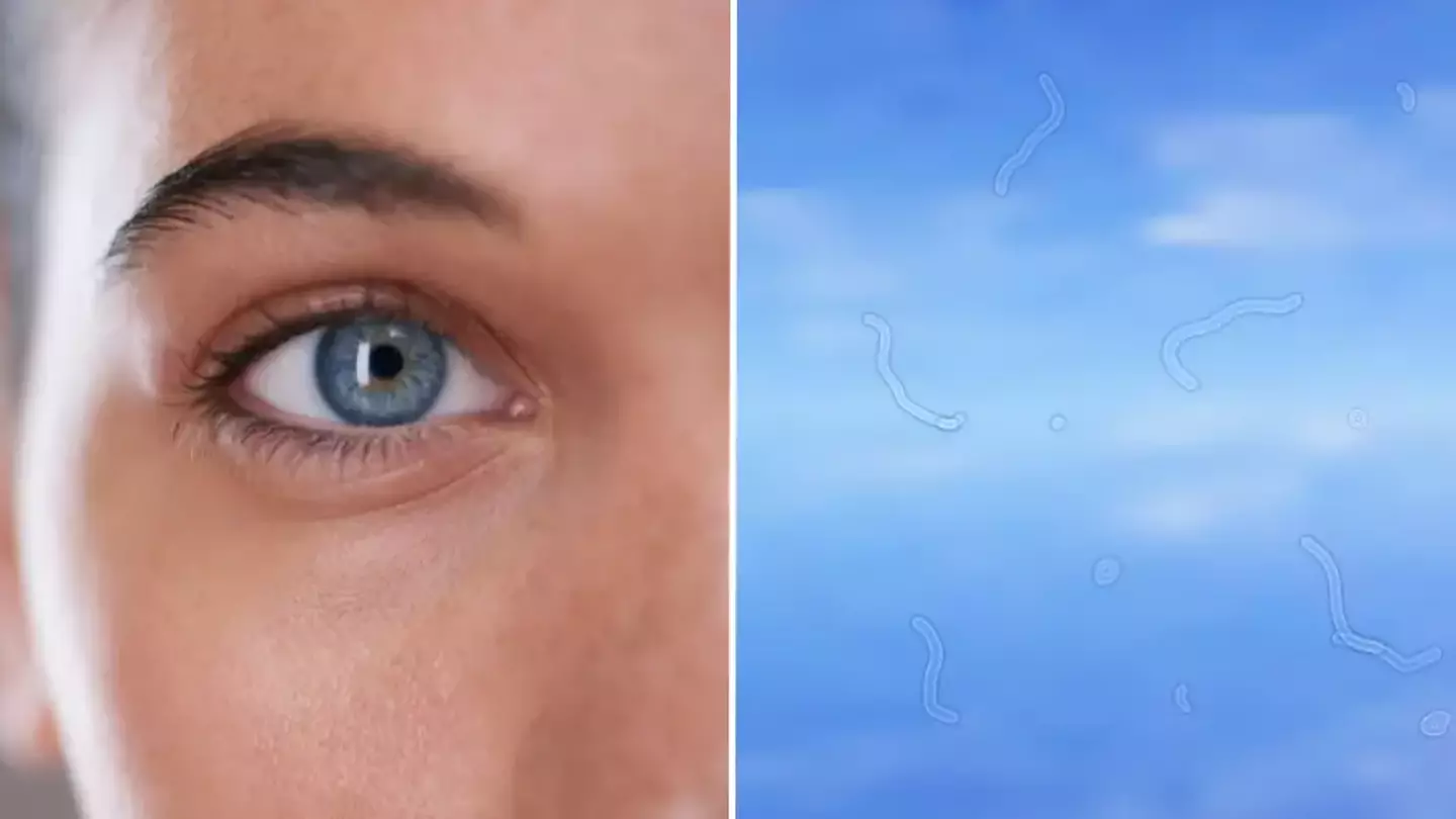 Eye doctor reveals when to be concerned about seeing ‘floaters’