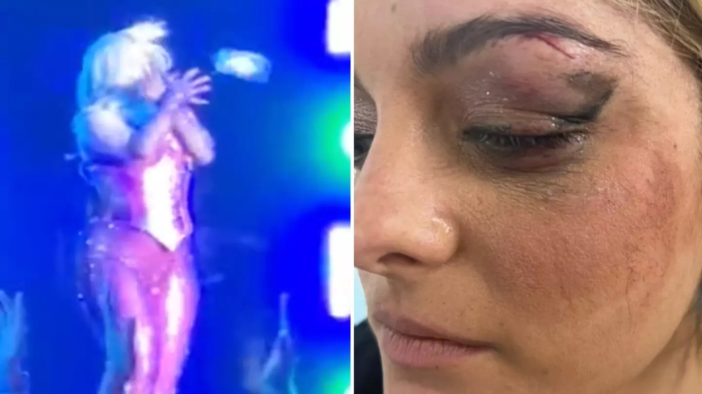 Man charged with hitting Bebe Rexha in the face with phone thought it would be 'funny'