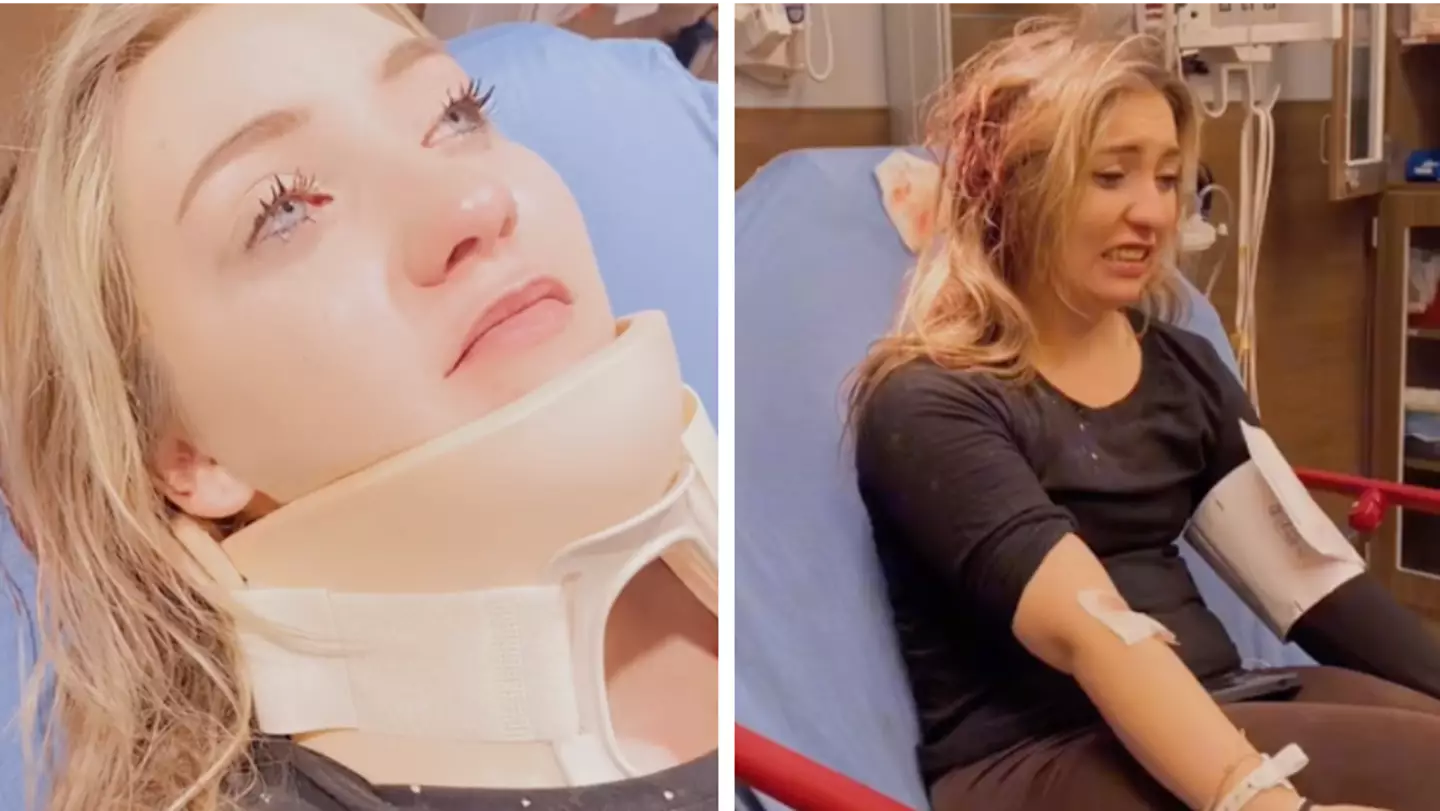 Woman issues warning after claw clip gets lodged in her head during car crash