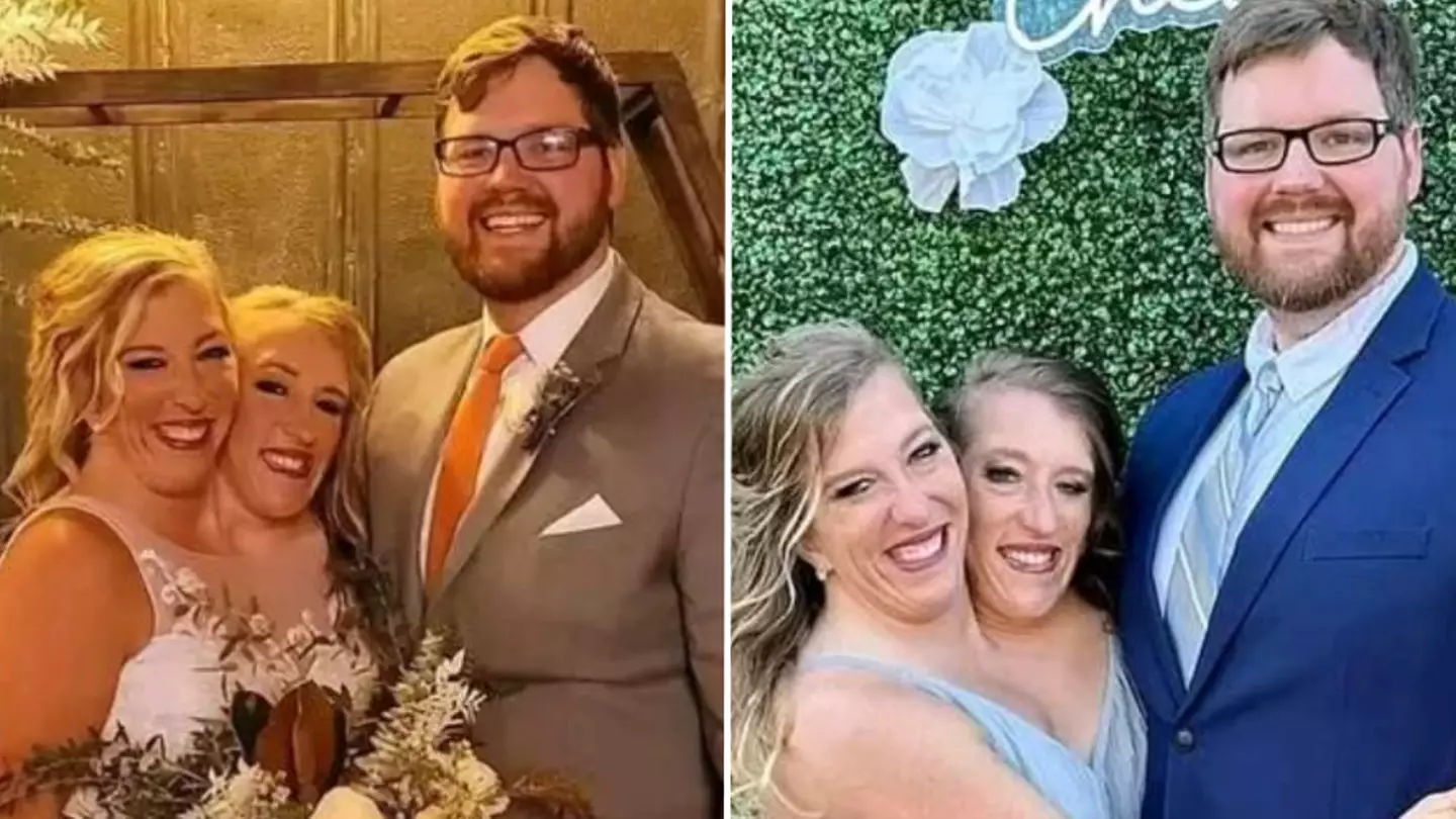Conjoined Hensel twins already answered question puzzling fans as they share never-before-seen wedding pictures