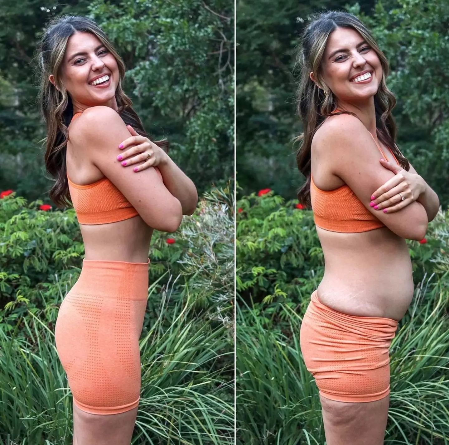 Bree posted a series of comparison pictures.