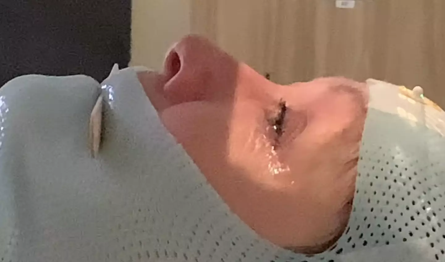 Doherty is undergoing radiotherapy.