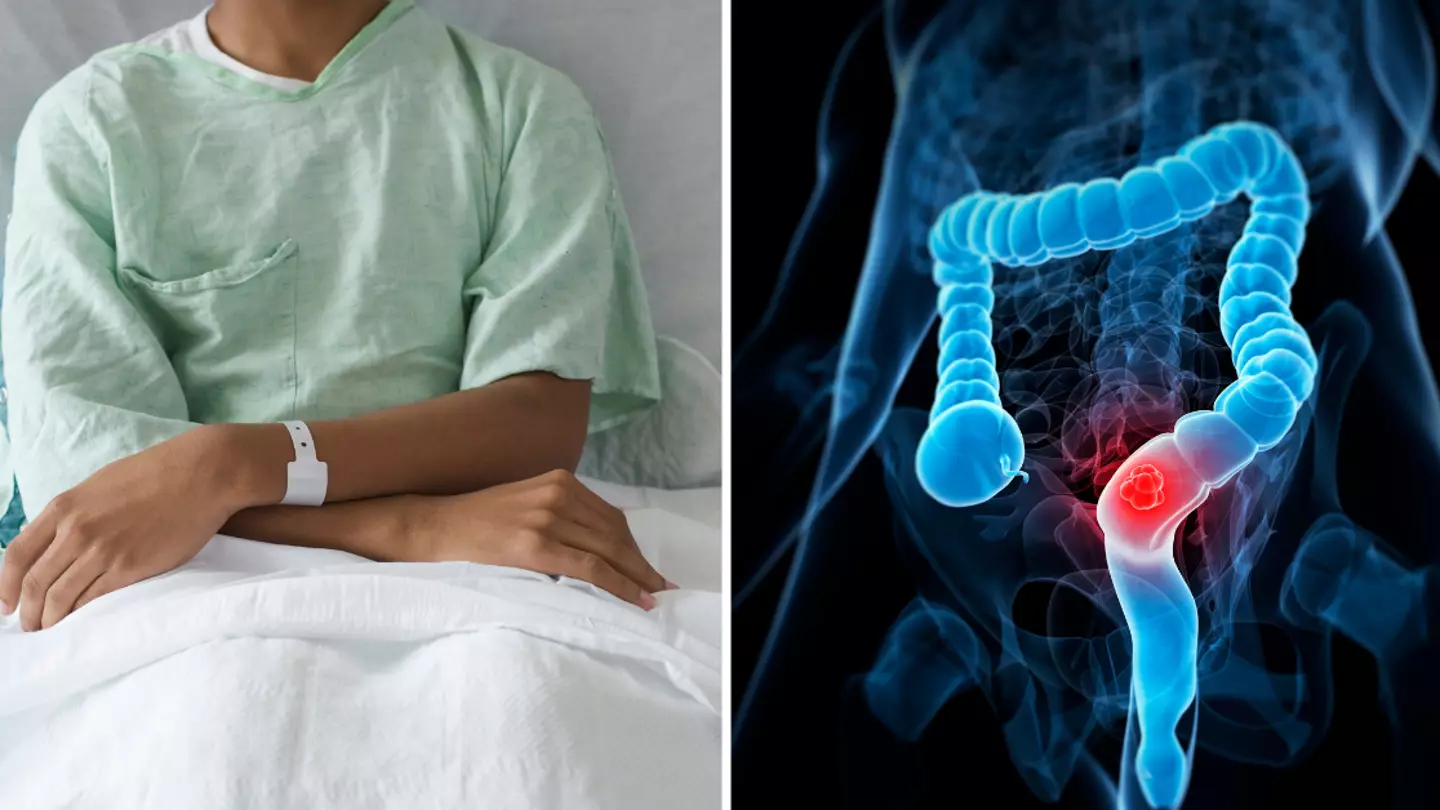 Scientists have one warning as highly ‘concerning’ cancer surges in people under the age of 50