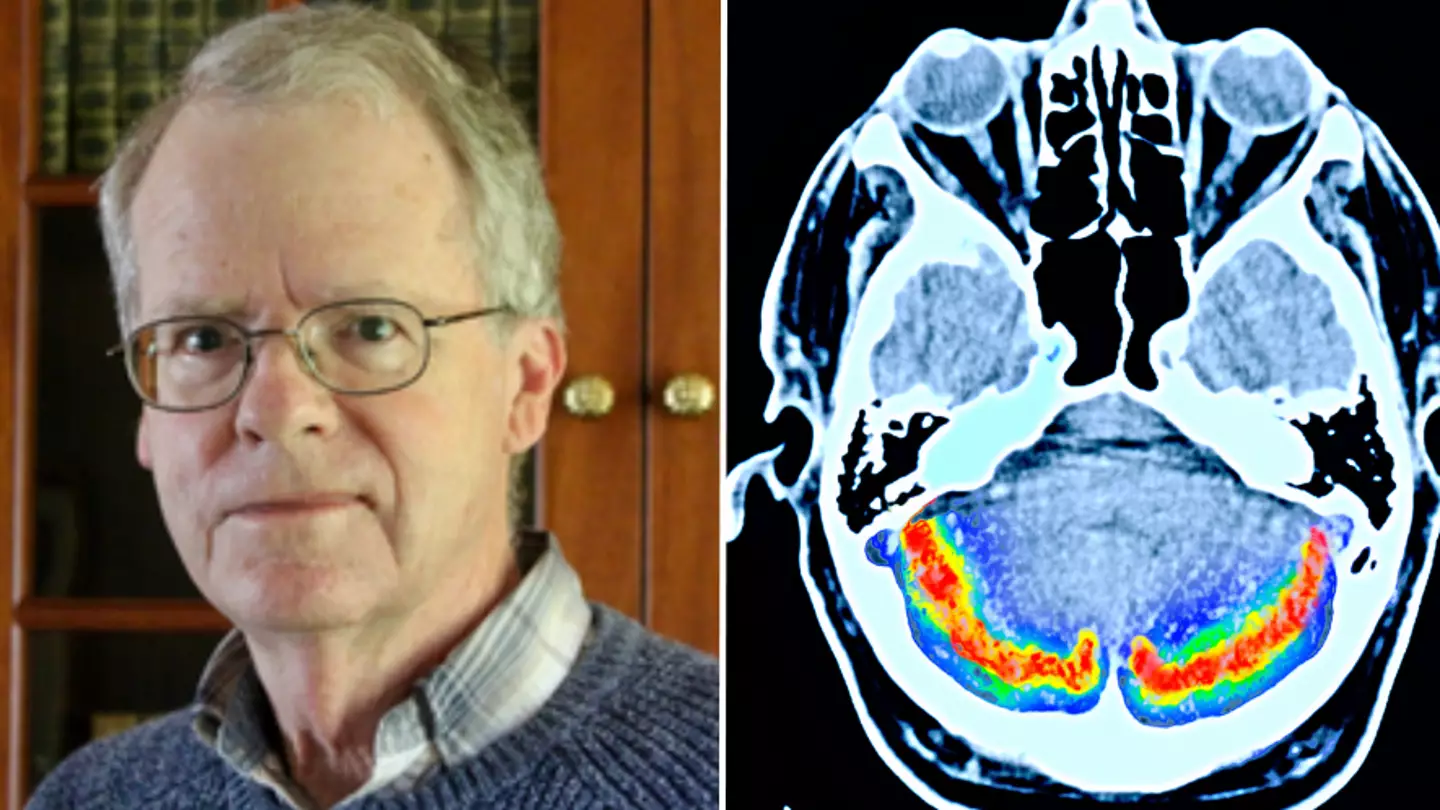 Doctor who diagnosed himself with Alzheimer’s reveals undetected warning sign to look out for
