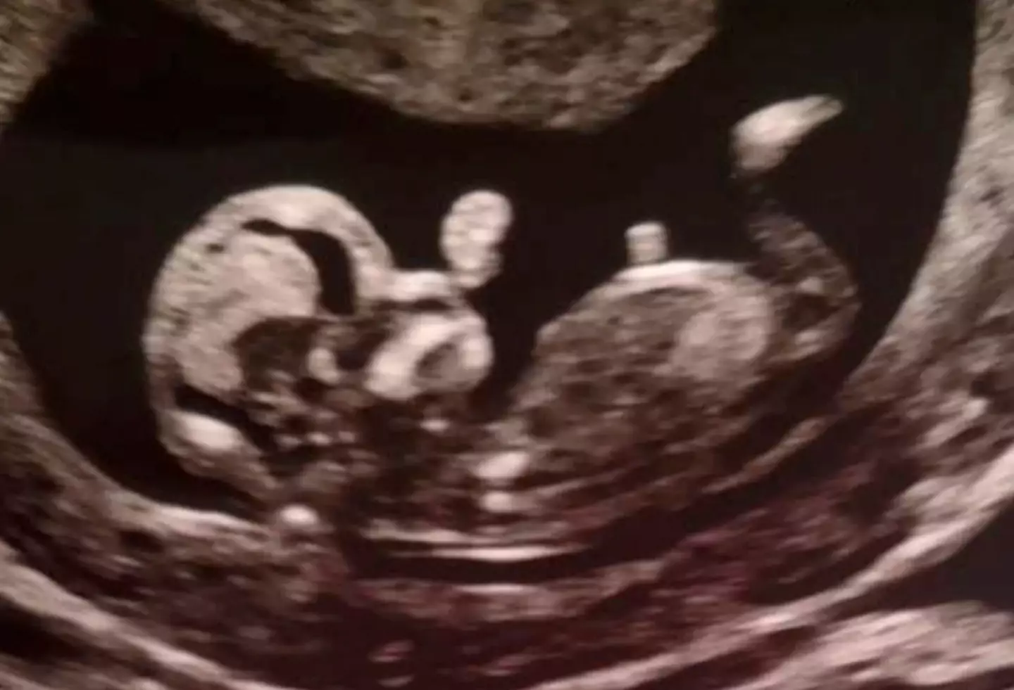 Following his death, Rob's family have announced that his girlfriend Jade Higgins is pregnant.