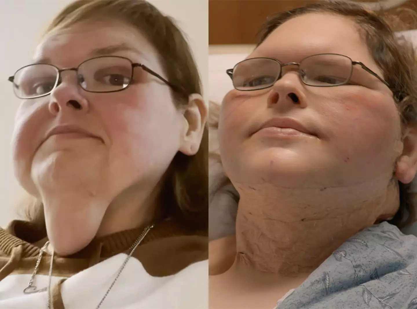 Fans rushed in to share their praise over Tammy Slaton's incredible transformation following her excess skin removal surgery (TLC)