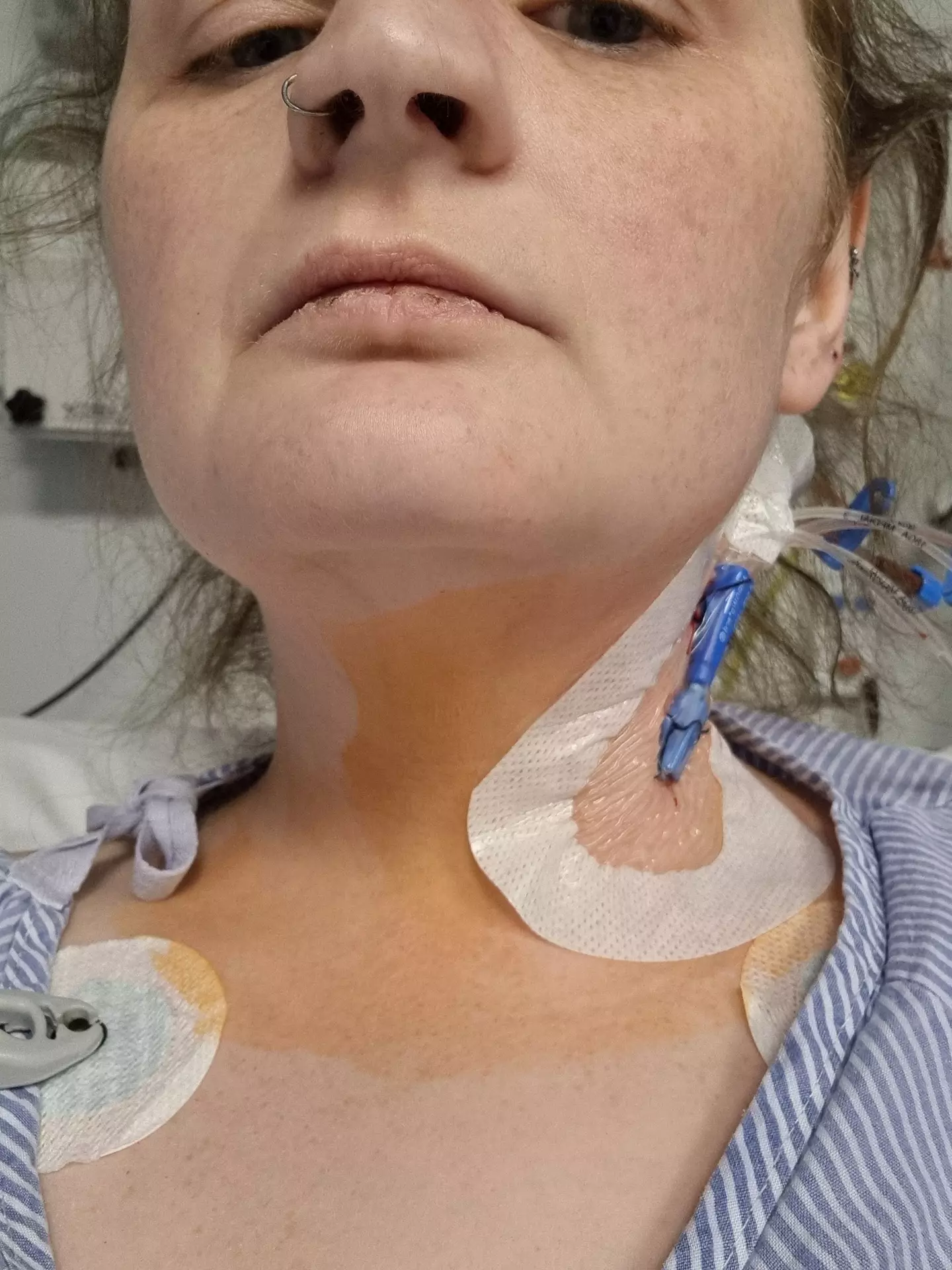 Aimee is now calling on others who are considering using the injectables to do their research and consult a doctor (Kennedy)