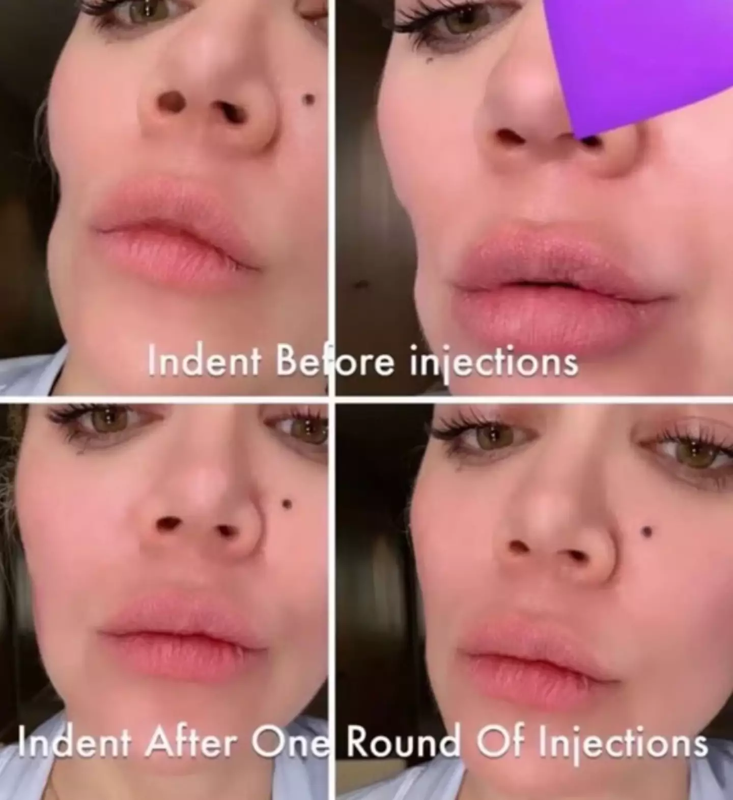 She shared the before and after pictures with fans. (Snapchat/Khloe Kardashian)