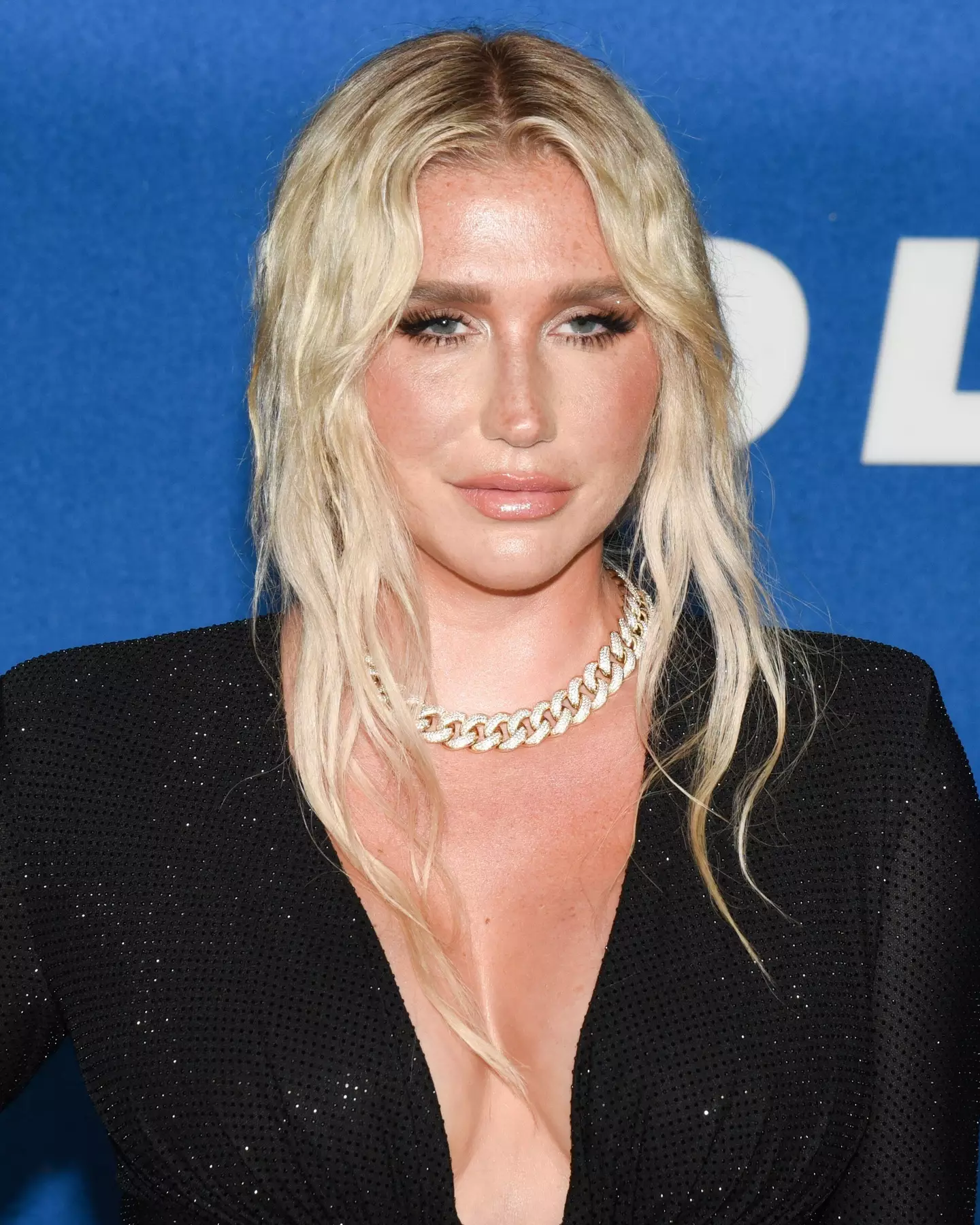 Kesha has opened up about her health.