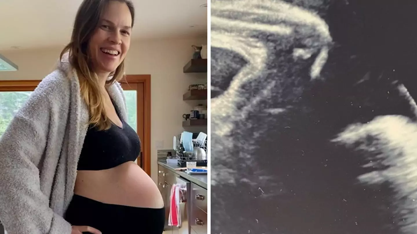 Hilary Swank shares ultrasound of one of her twins flexing its bicep