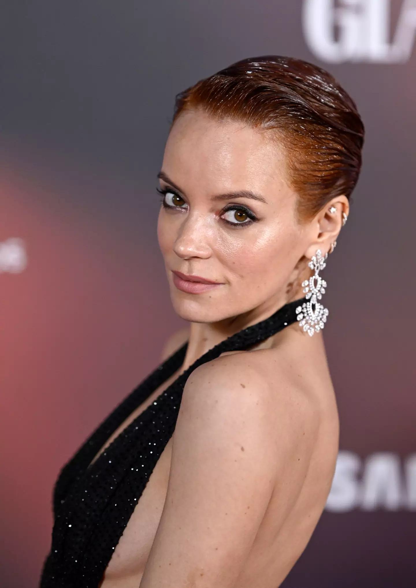 Lily Allen has been honest about her struggles with mental health (Ammar Rowaid/Patrick McMullan via Getty Images)