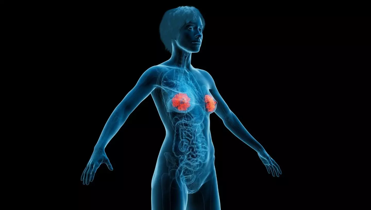 'Burger nipples' is a derogative descriptor, often used online to put down people with large areolae (Getty Stock Image)