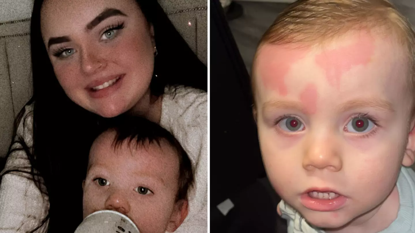 Mum horrified after toddler covered in ‘red swollen welts’ minutes after bathing him with baby shampoo