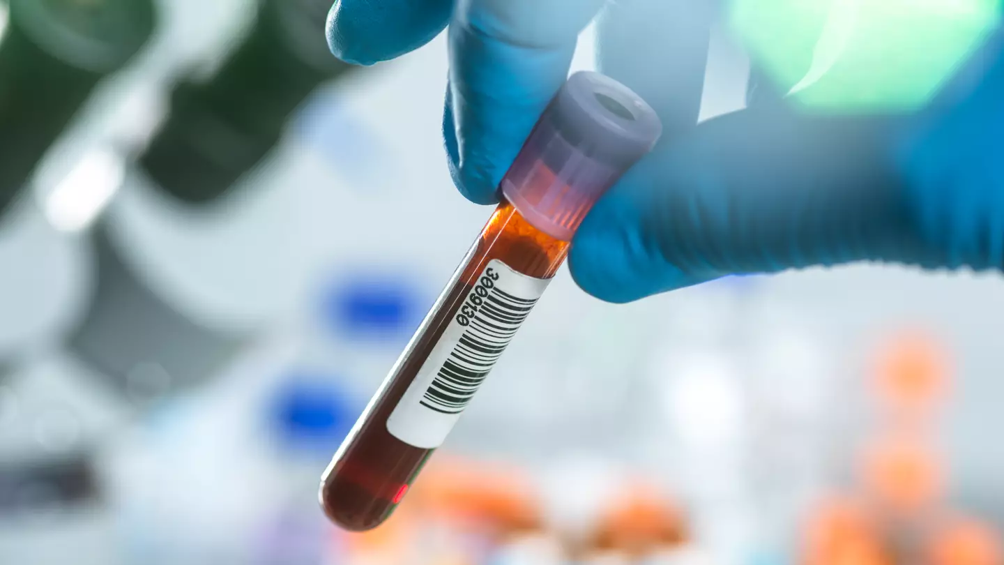 Study claims certain blood types have increased risk of common cancer that is rapidly increasing among young people