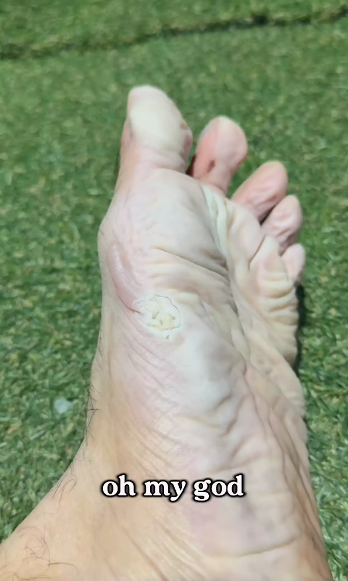 The runner gave a glimpse at his feet (Instagram/@rob.sembiante)