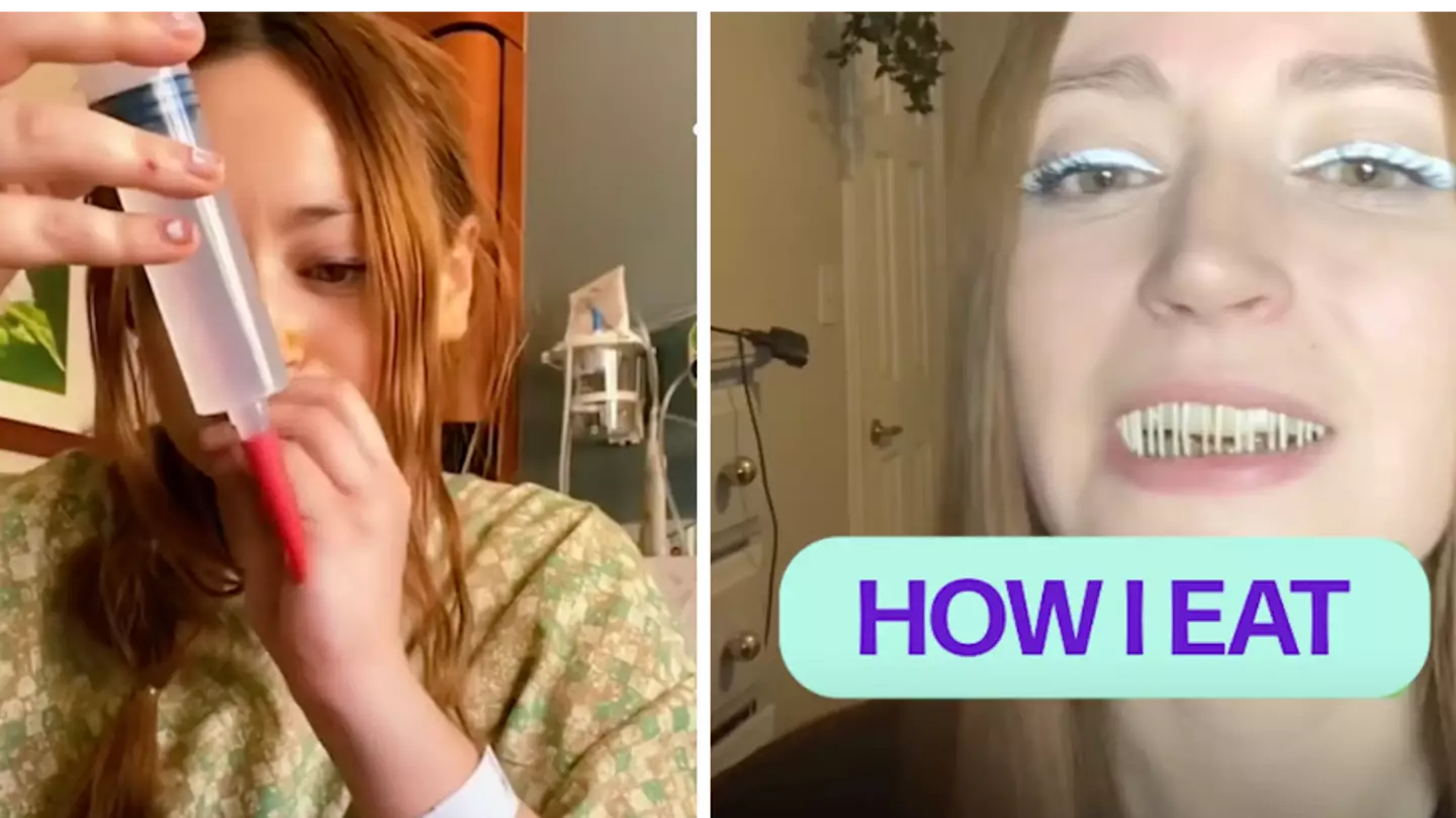 Woman Reveals What It's Like Living With Her Jaw Wired Closed